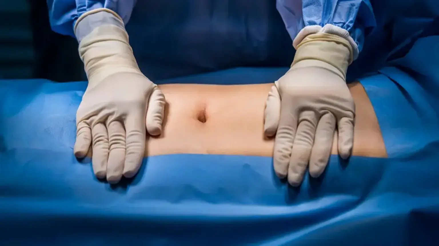 Laparotomy
