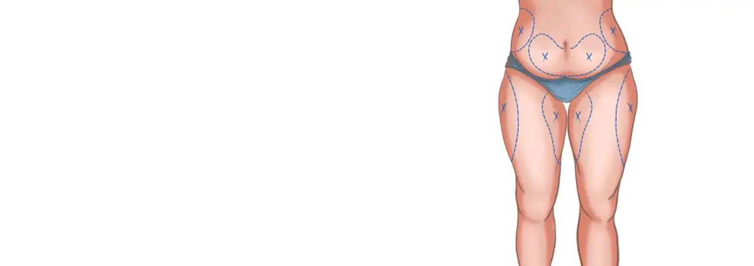 Nonna Grishaeva jinsiy aloqada