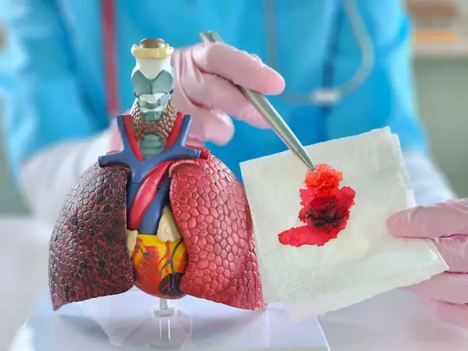 Lung Cancer Care and Treatment