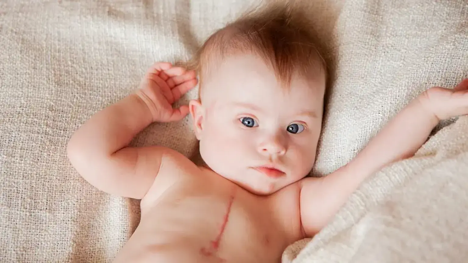 Pediatric Open Heart Surgery