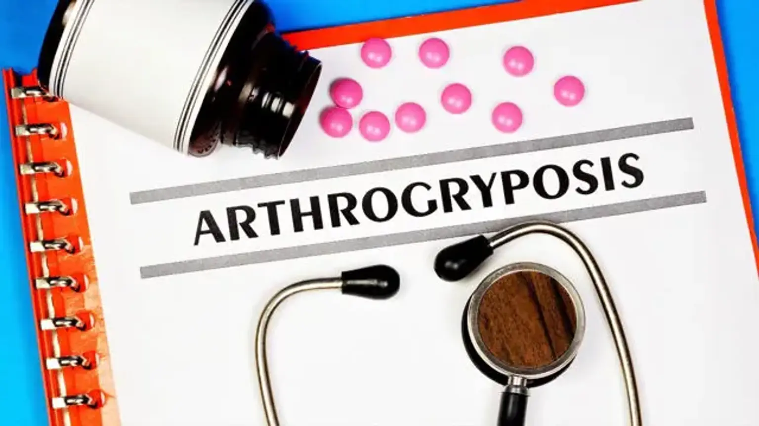 Arthrogryposis