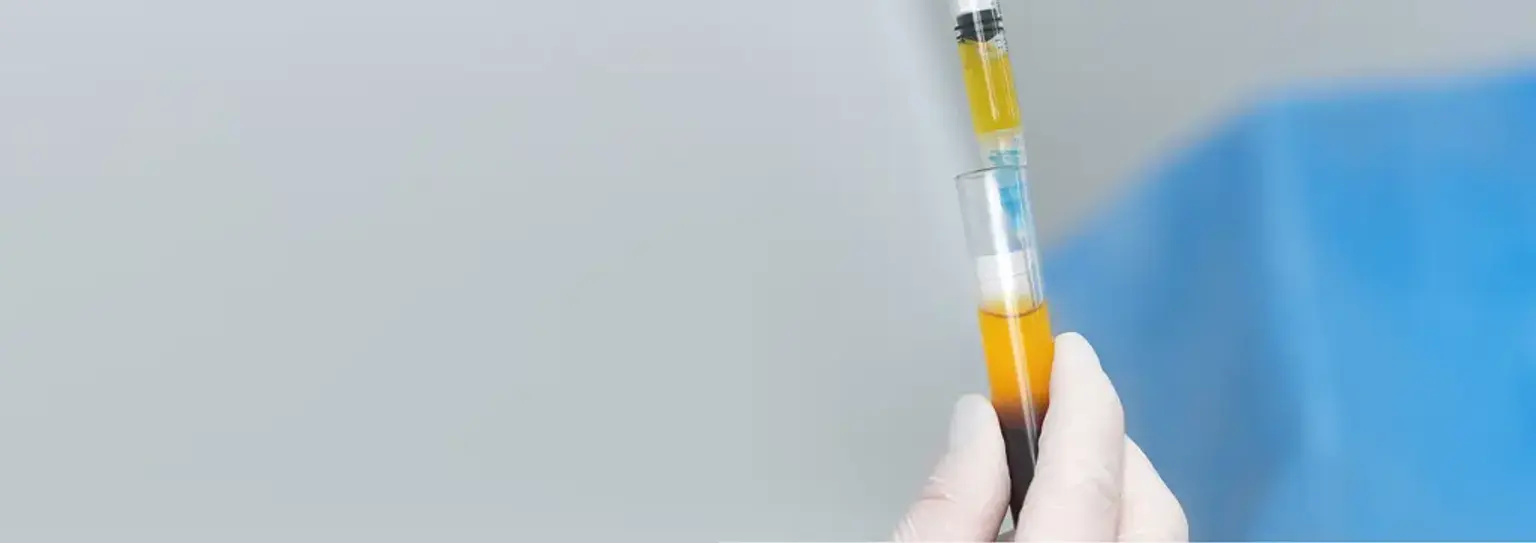 PRP Therapy