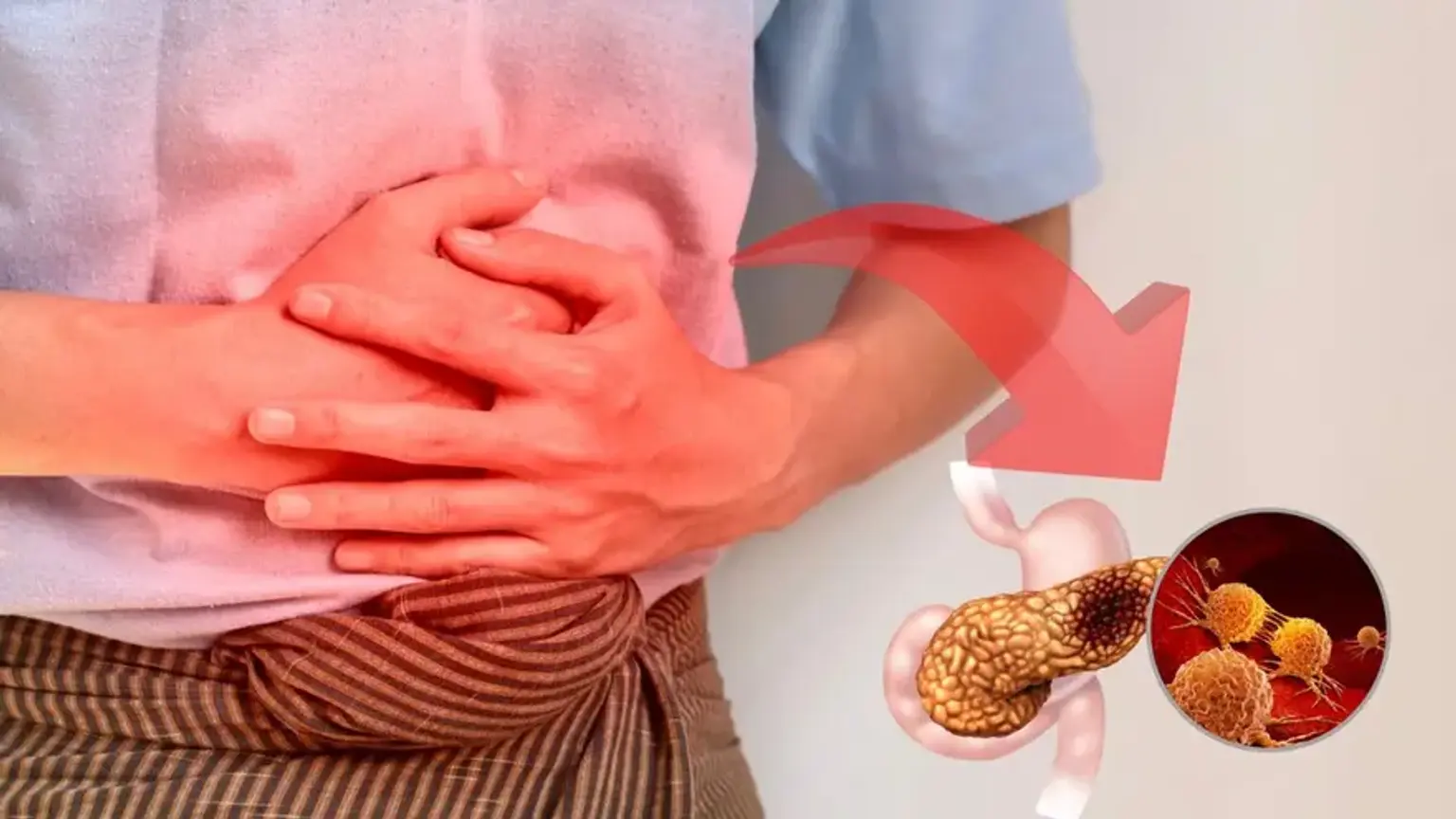 Pancreatic Cancer Treatment