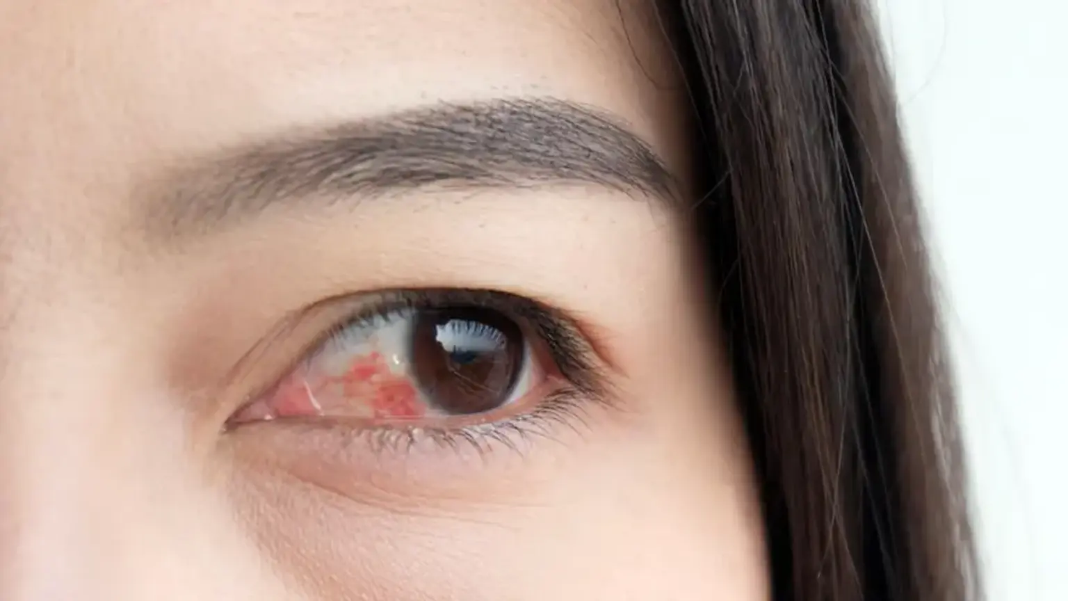 Retinal