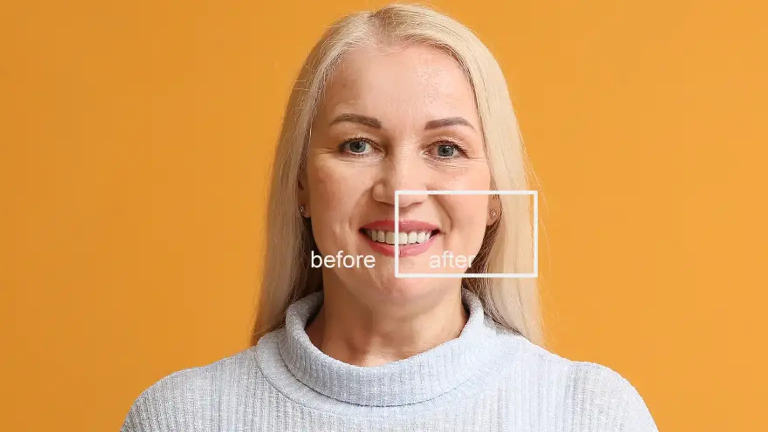 Same Day Smile Makeover