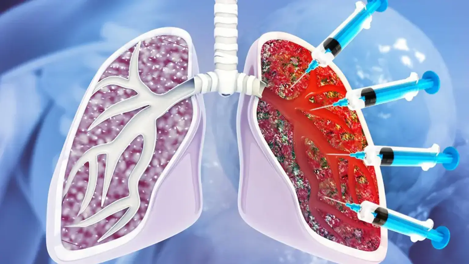 TB Diagnosis and Treatment