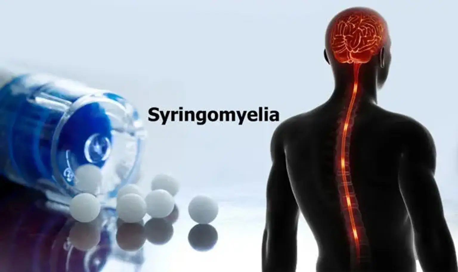 Syringomyelia