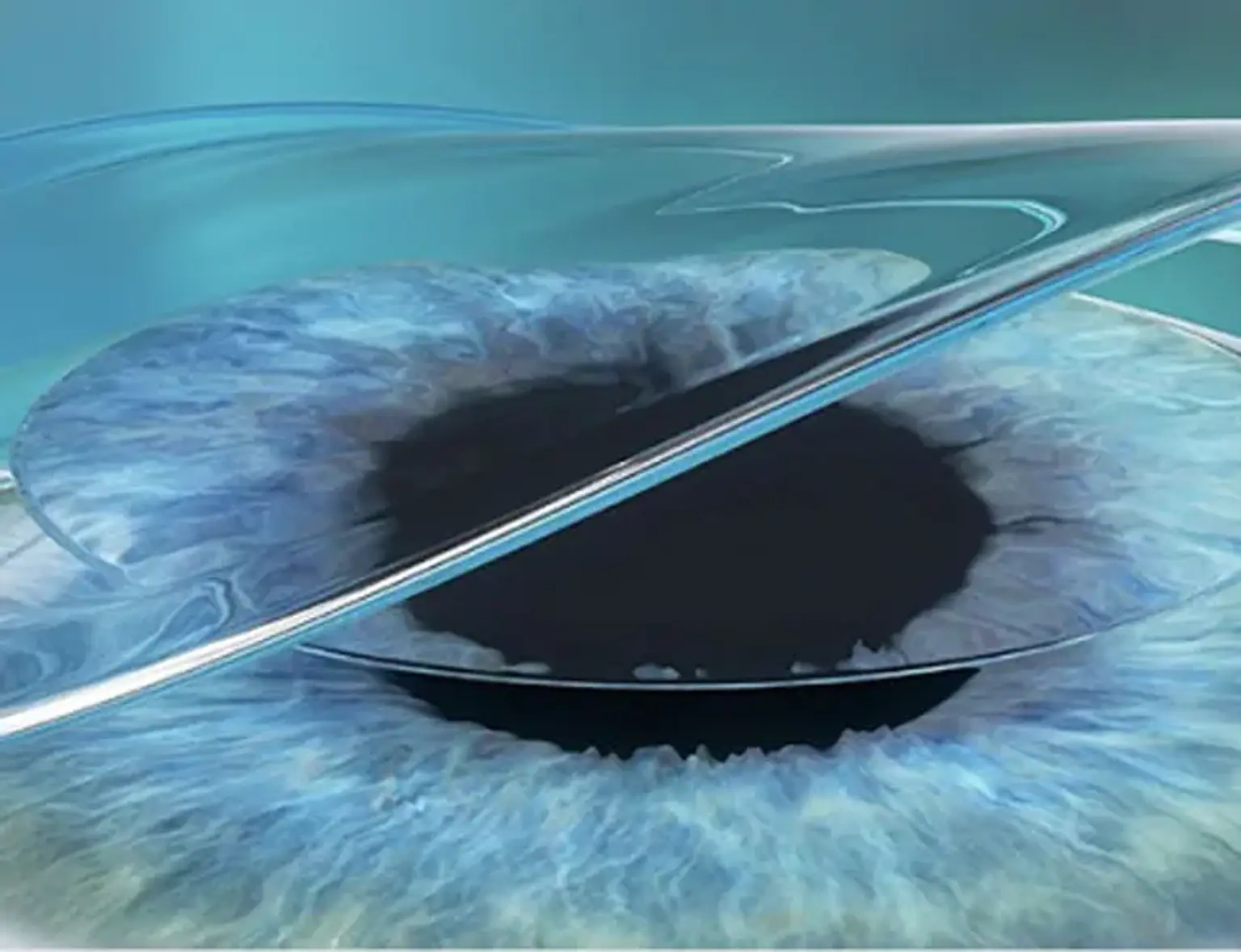 Preparing for Your Eye Enucleation Surgery in Korea: A Patient's Checklist