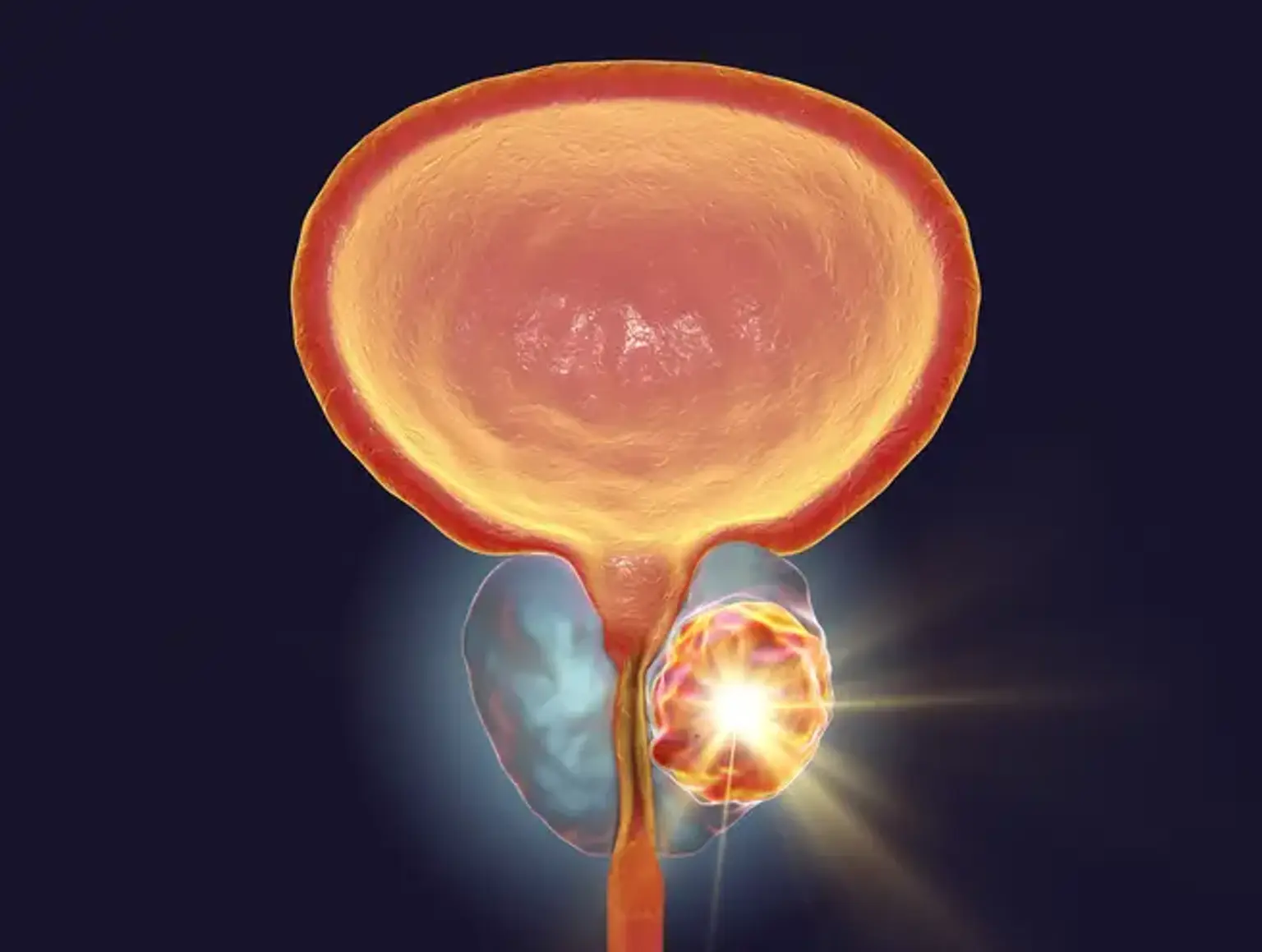 Robotic Prostatectomy (Da Vinci): A Closer Look in Korea