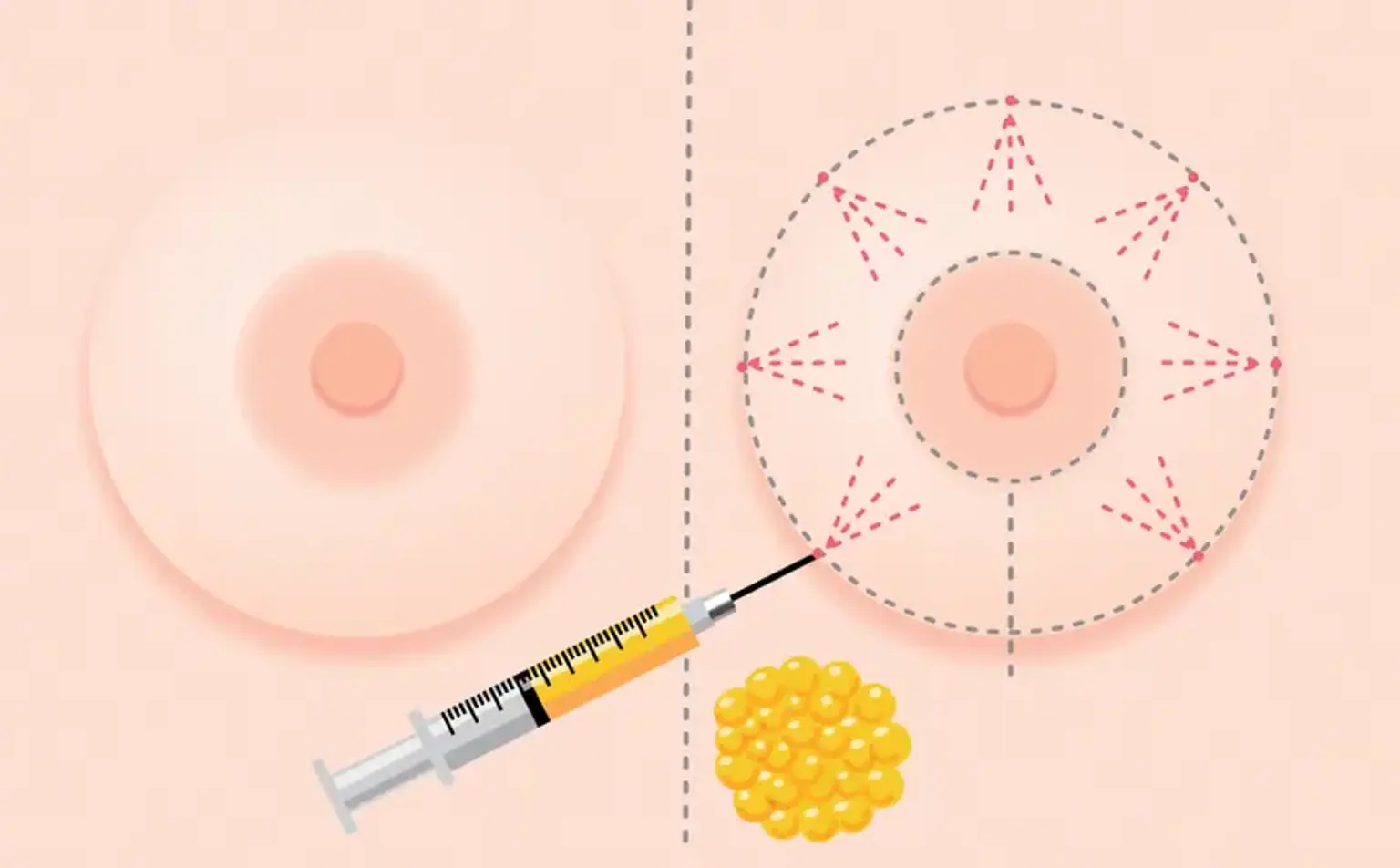 Brauzeringizdan ogiz pornosini olib tashlang