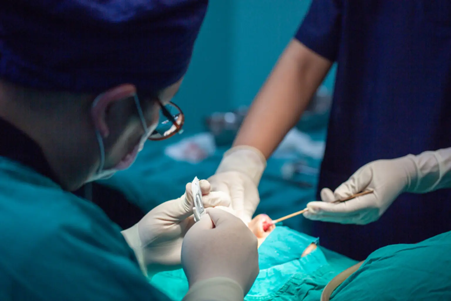 Rhinoplasty