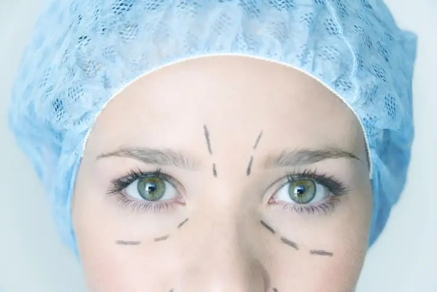 A Patient's Guide: Choosing the Best Clinic for Eyelid Surgery in Busan