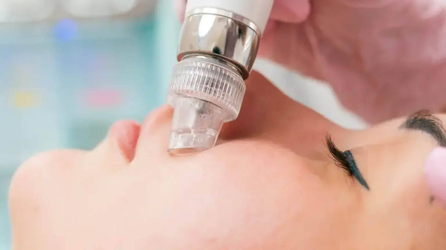 Aqua peel