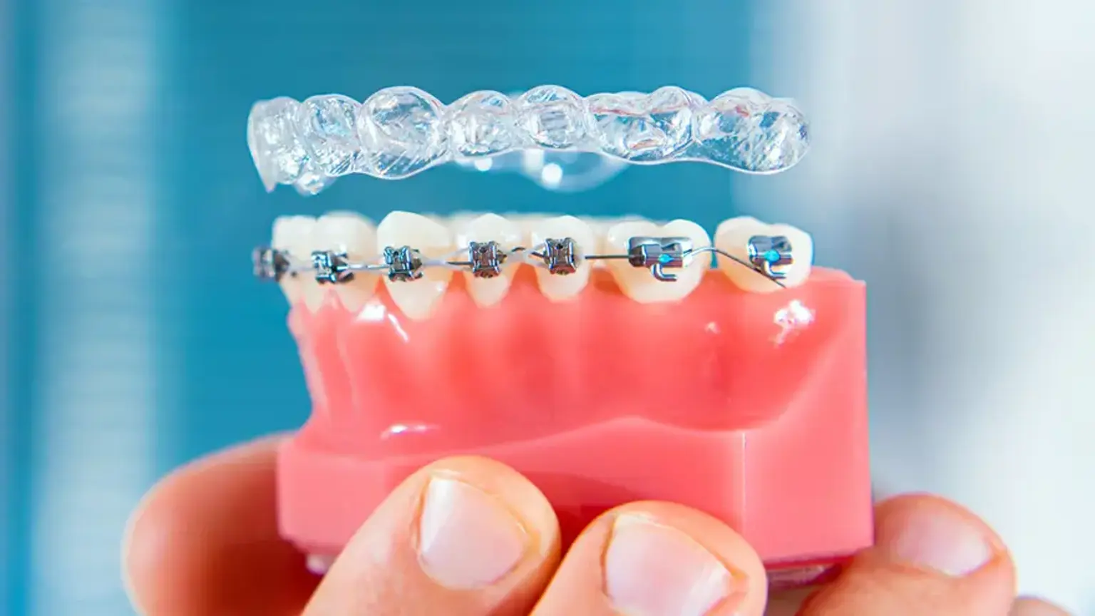 Choosing Between Braces and Clear Aligners in Korea