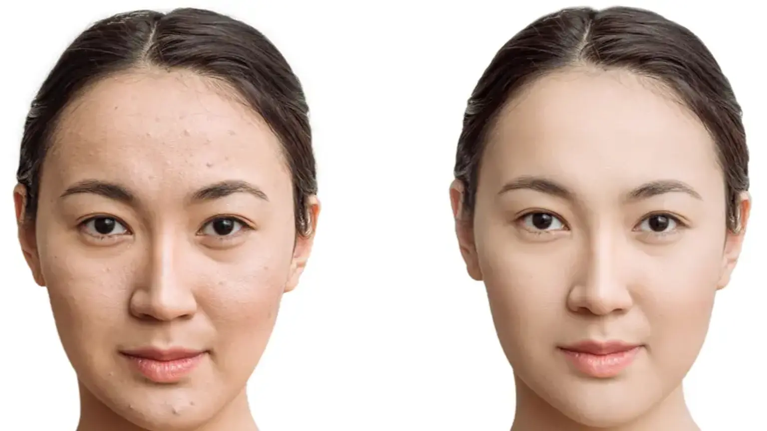 Korean Plastic Surgery