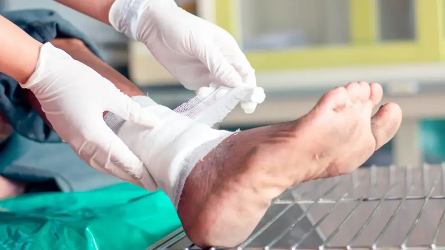 New Bionic Dressing Combines Passive Cooling with Light-Activated ...