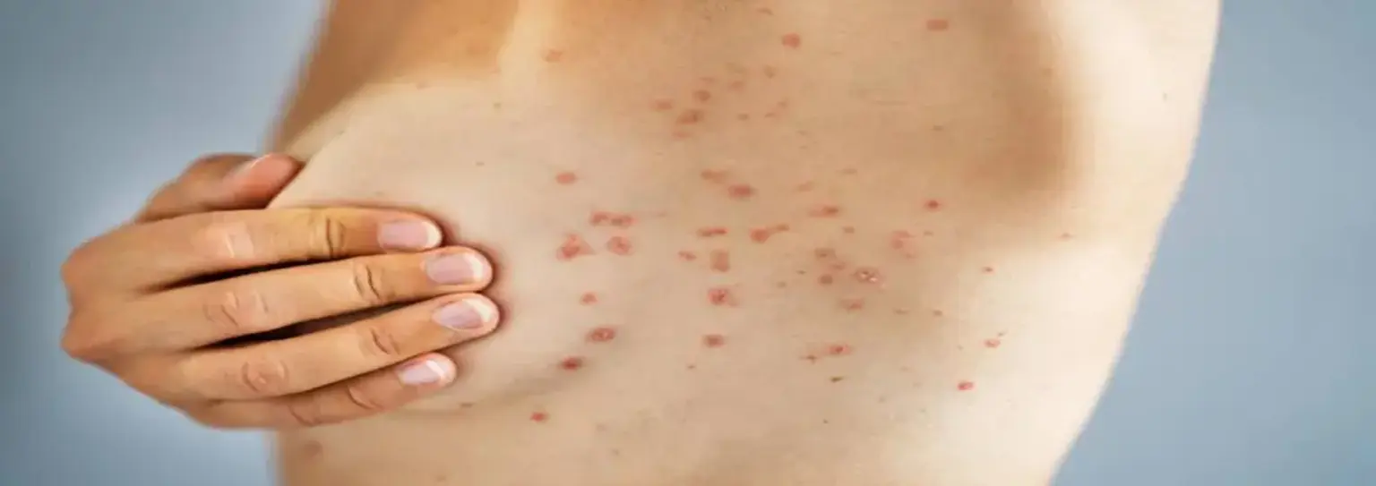 Bokira mushuk surati