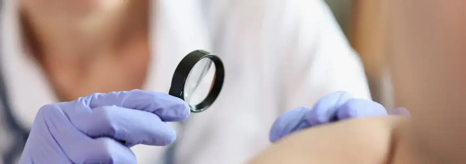 Erupções cutâneas: causas, fatores de risco, sintomas, tratamento, image size:1536x543