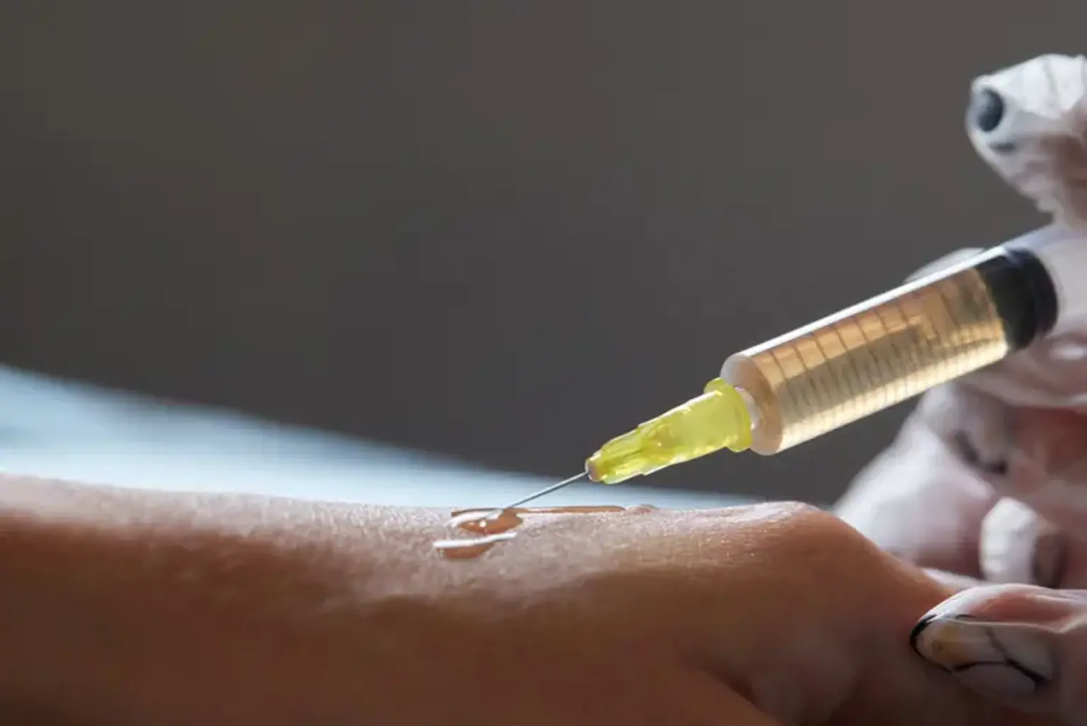 Why a New Regenerative Injection May Reverse Osteoarthritis Within Weeks