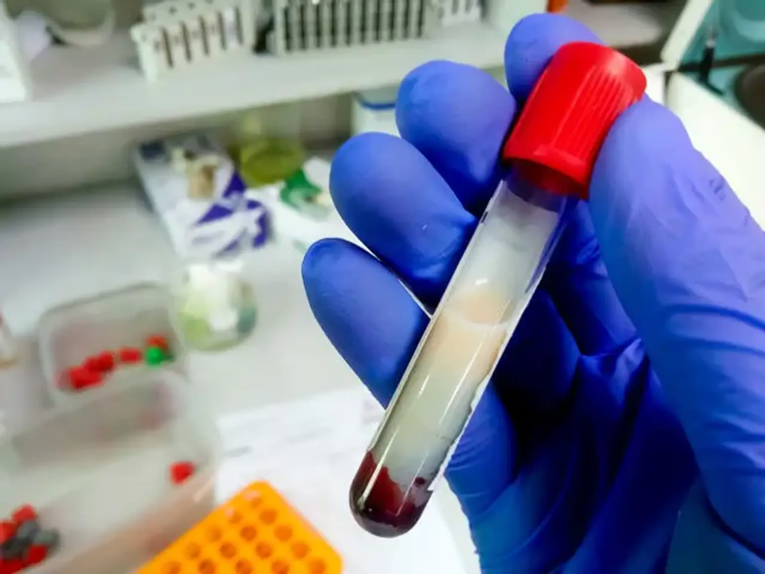 Metabolismo lipídico