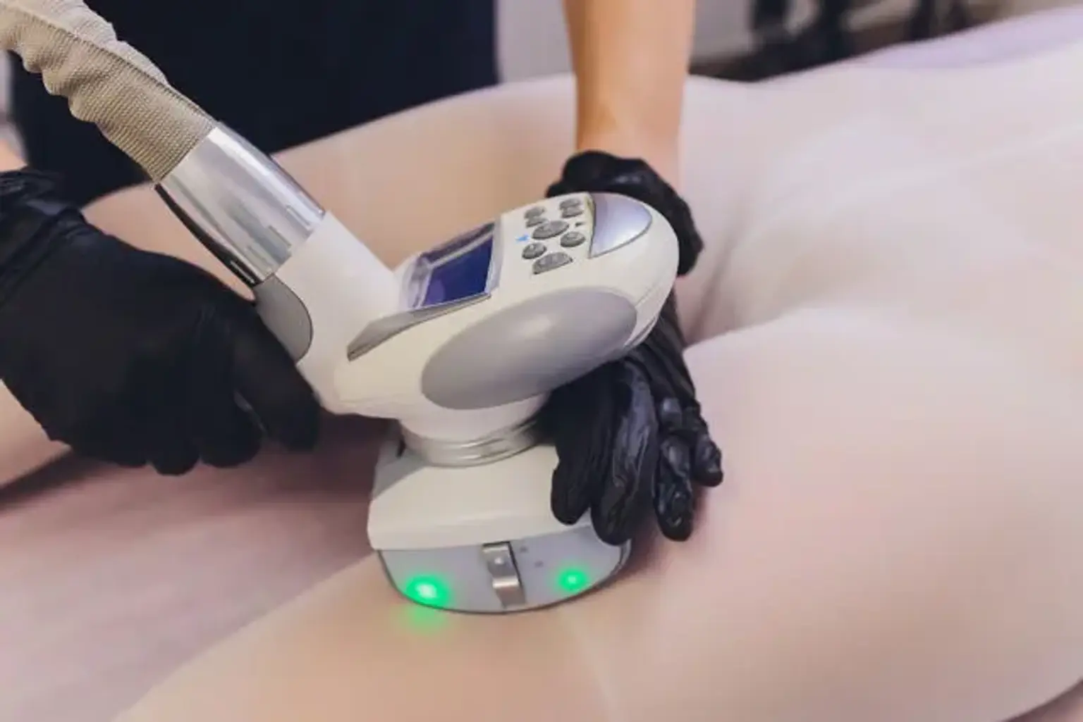 Accusculpt (liposucción laser)