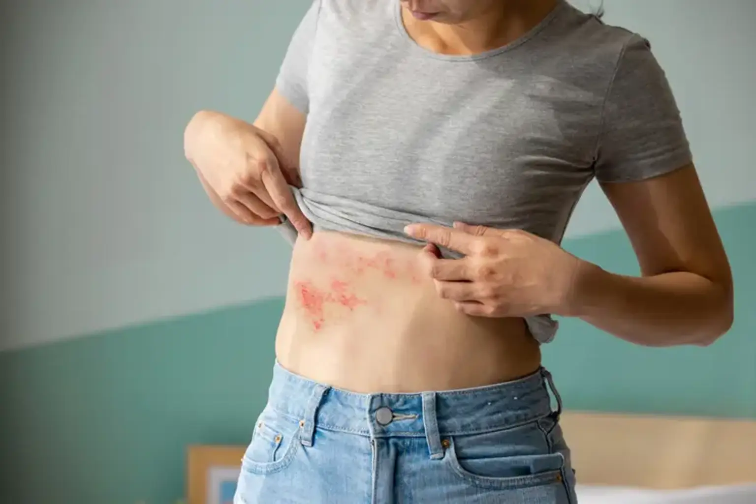 b12 injection for shingles Shingles: A Complete Guide to Causes, Symptoms, and Treatment Options 5 amino 1mq injection amino acids infusion Size:1000 mcg/ml - 10 ml x 1