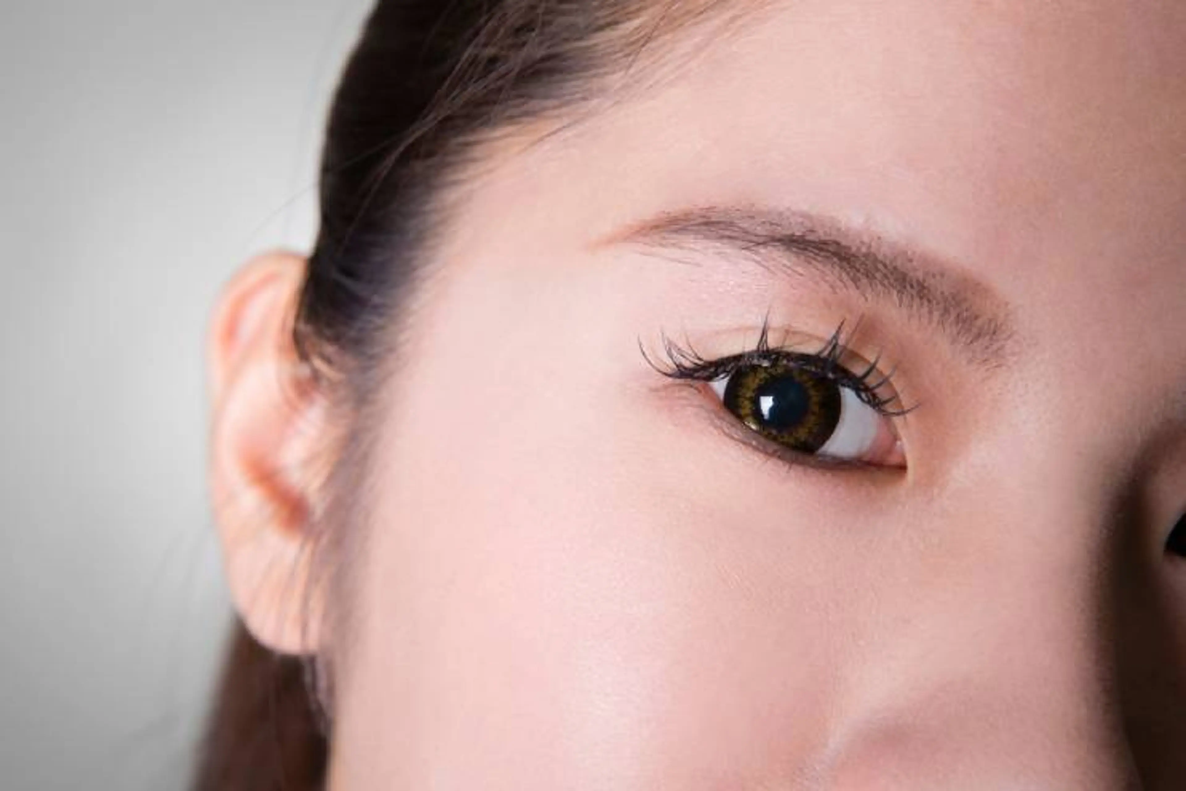 Non-Incisional Double Eyelid Surgery