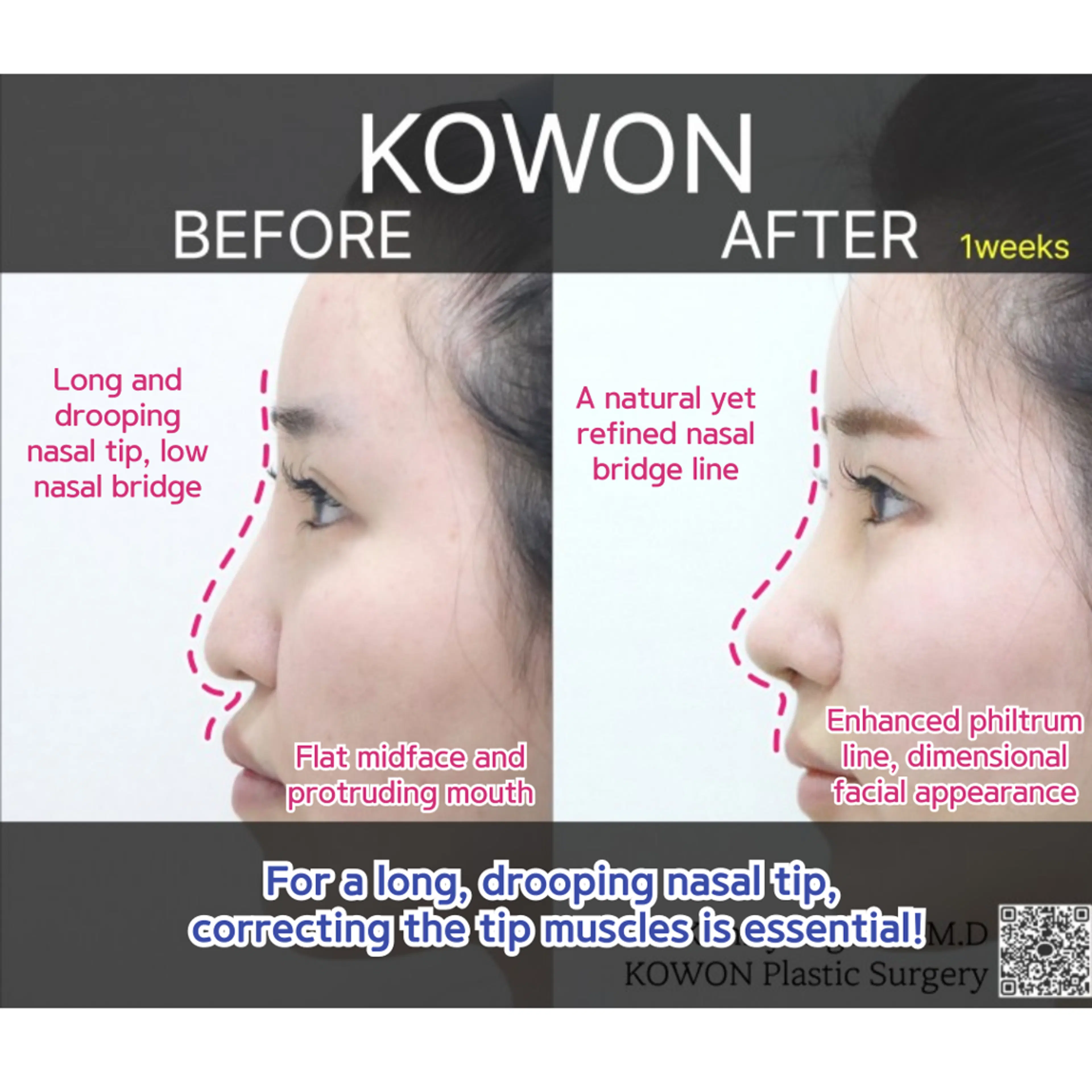 Kowon Plastic Surgery