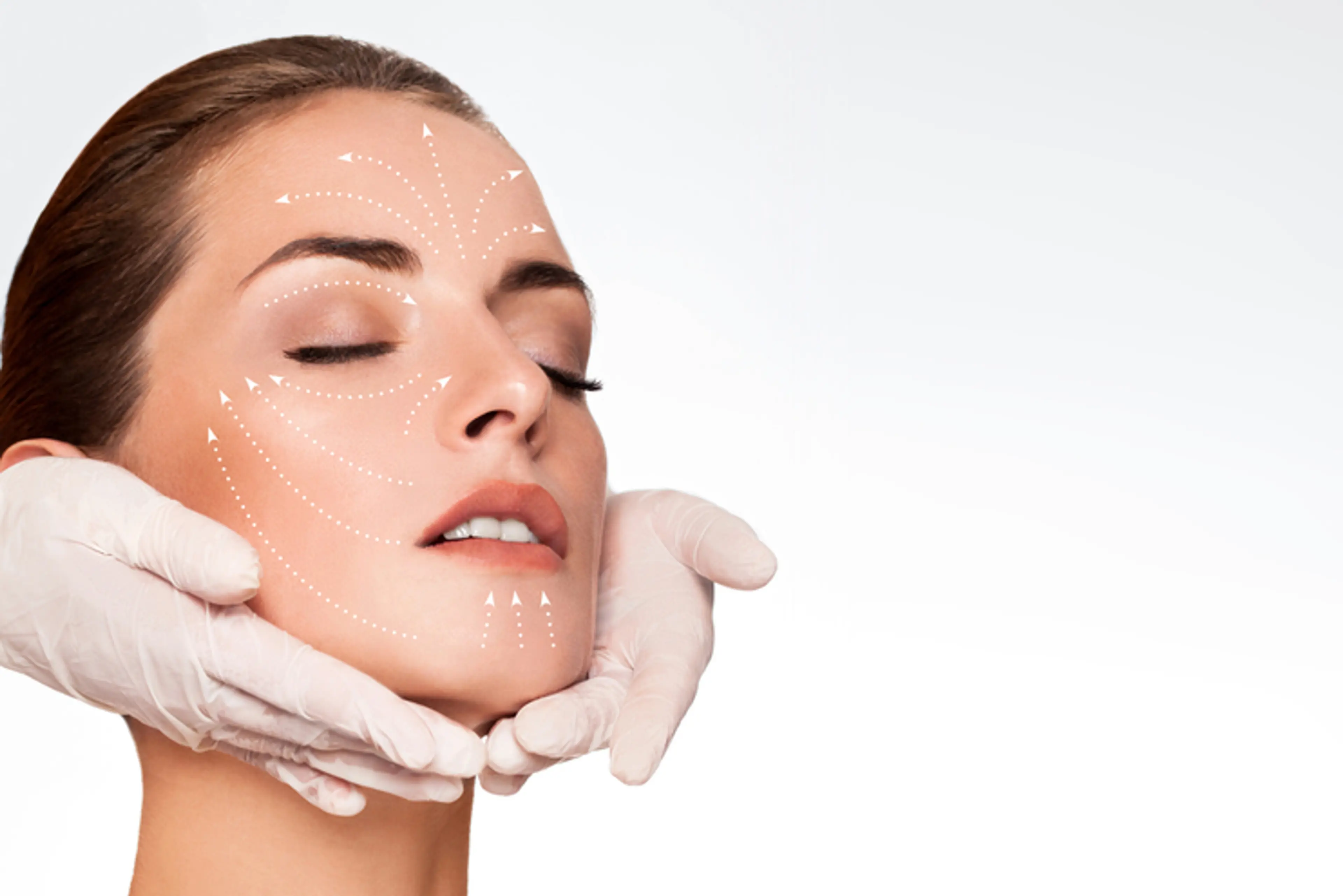 Facelift