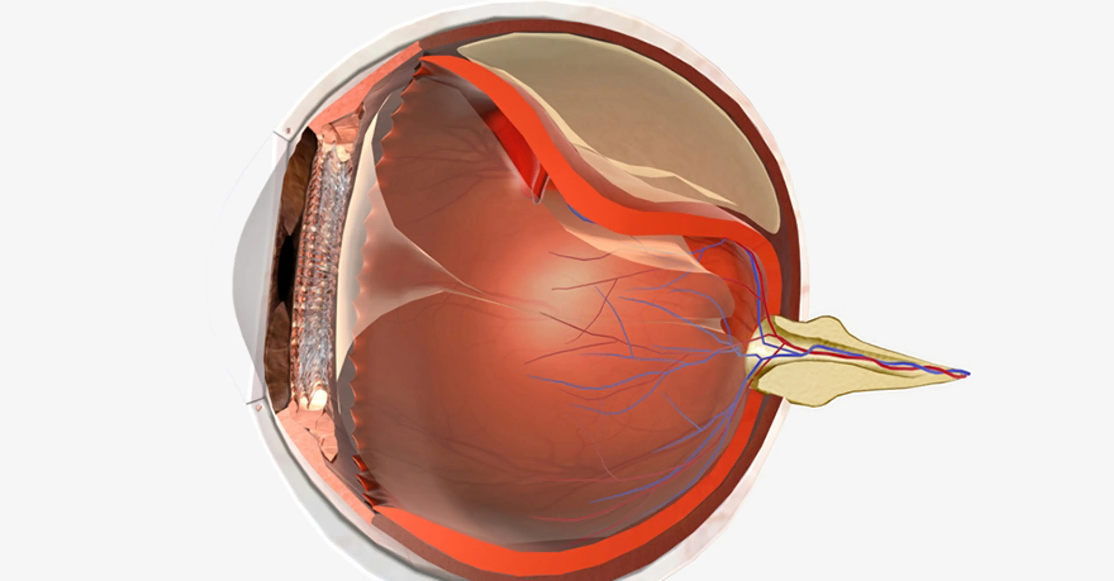 Cross-sectional medical illustration of the human eye showing the retina, optic nerve, and internal eye structures related to retinal disease