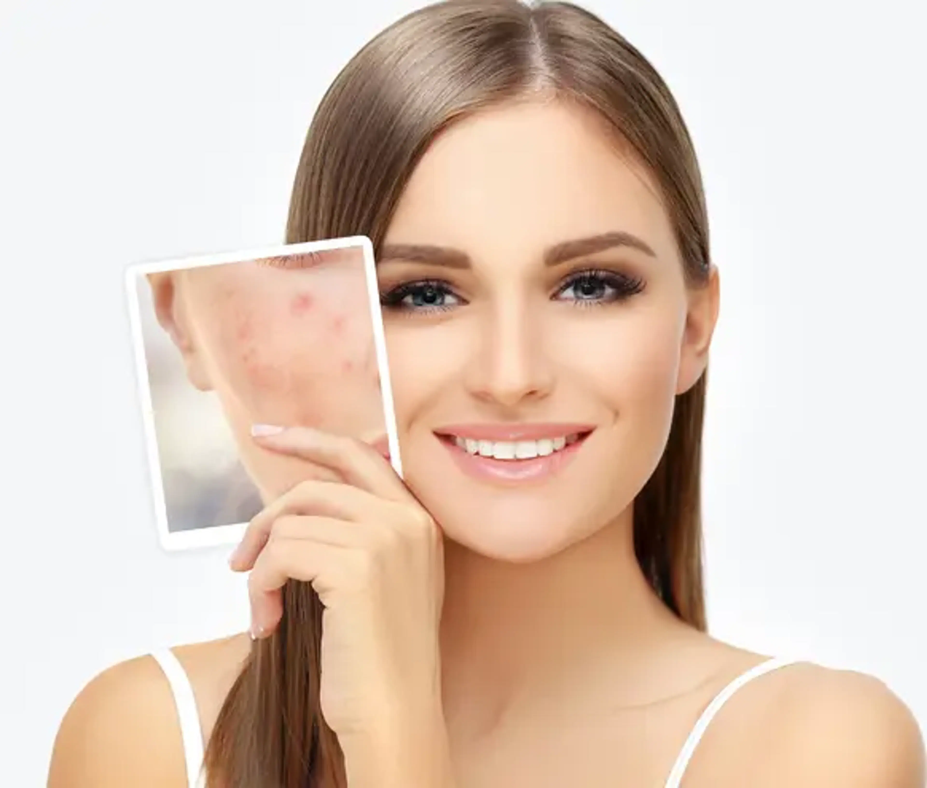 Skin Treatment