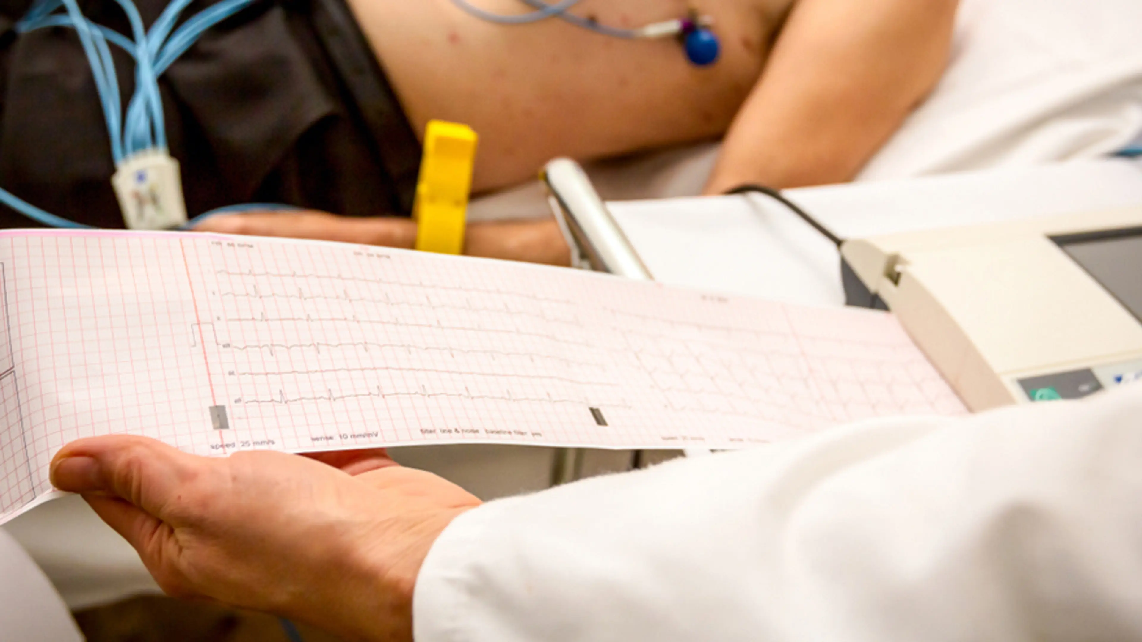 ECG or EKG