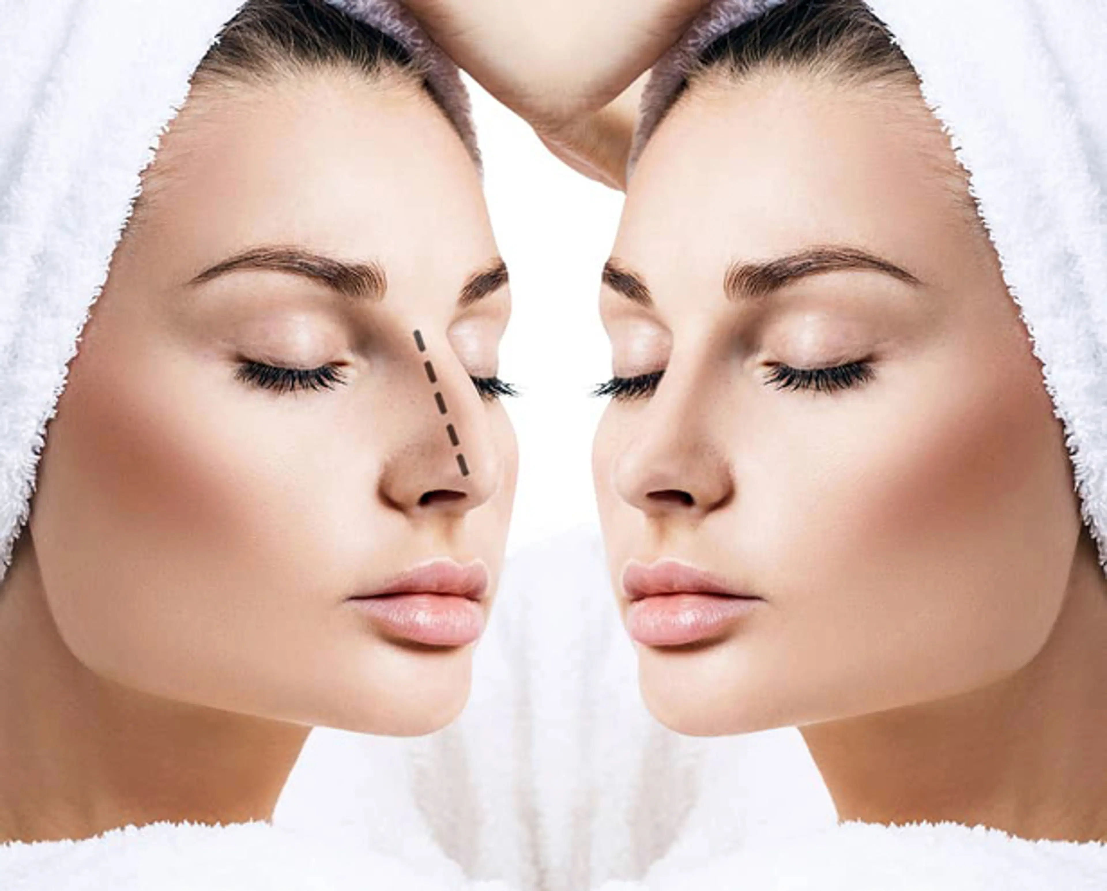 Good vs. Bad Nose Job