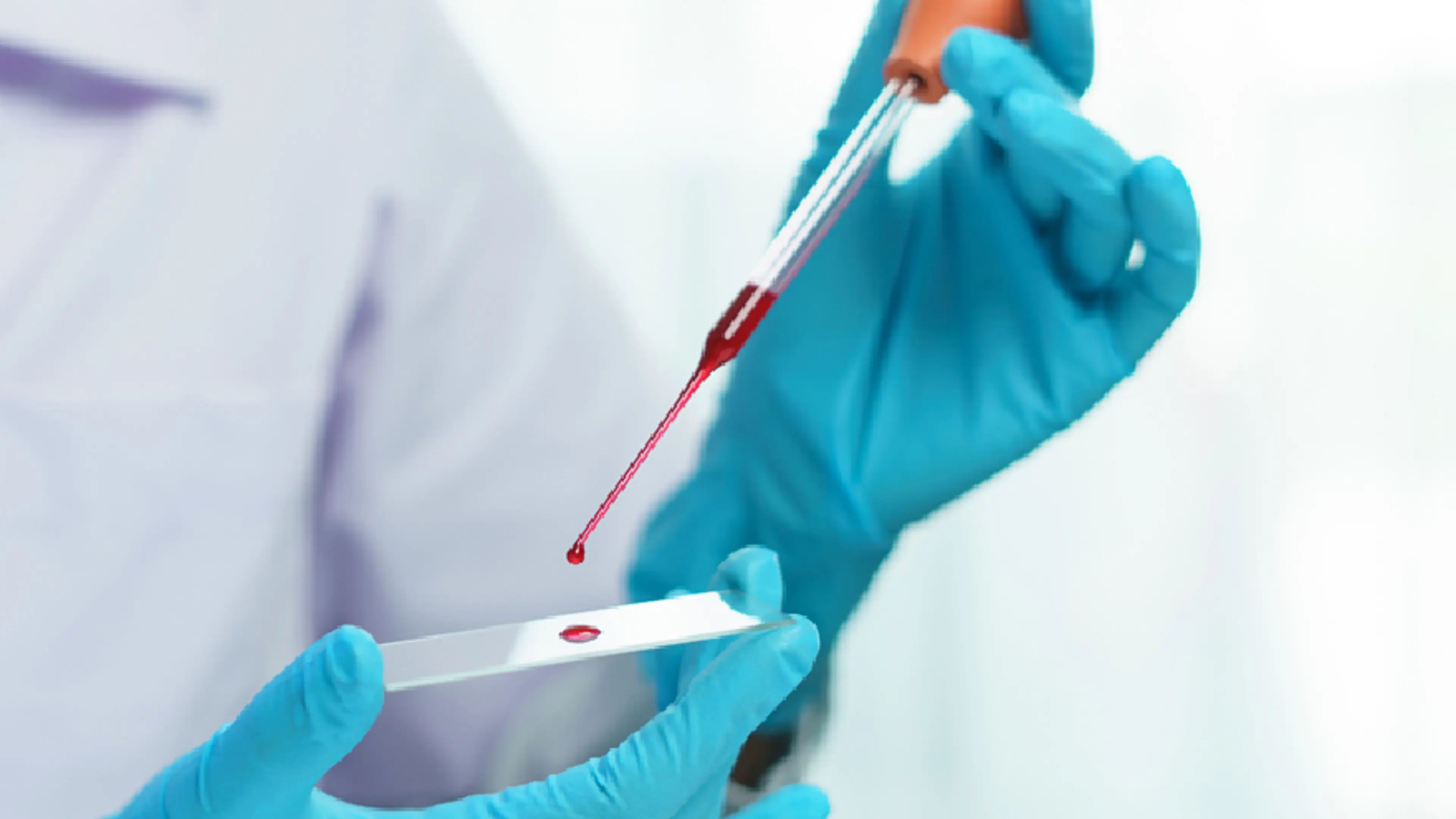 Blood Tests