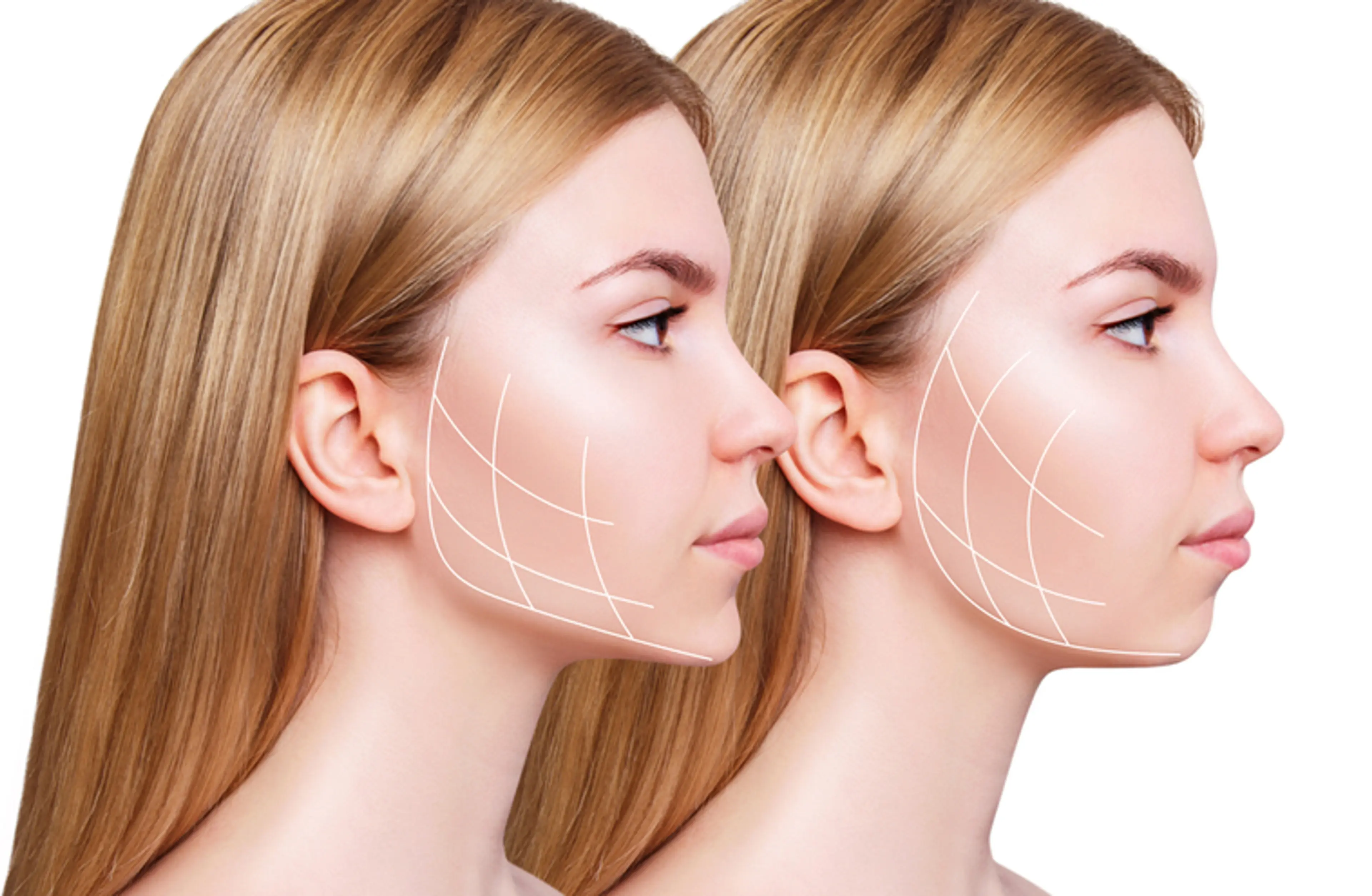 Jaw Surgery