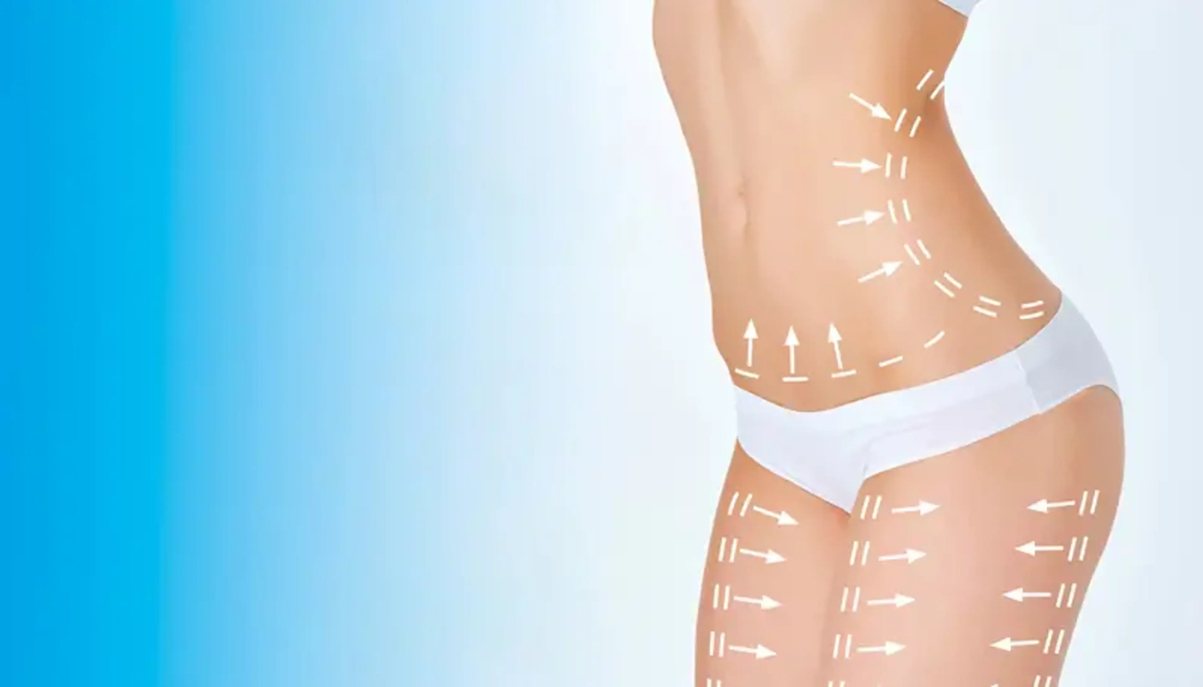 Liposuction