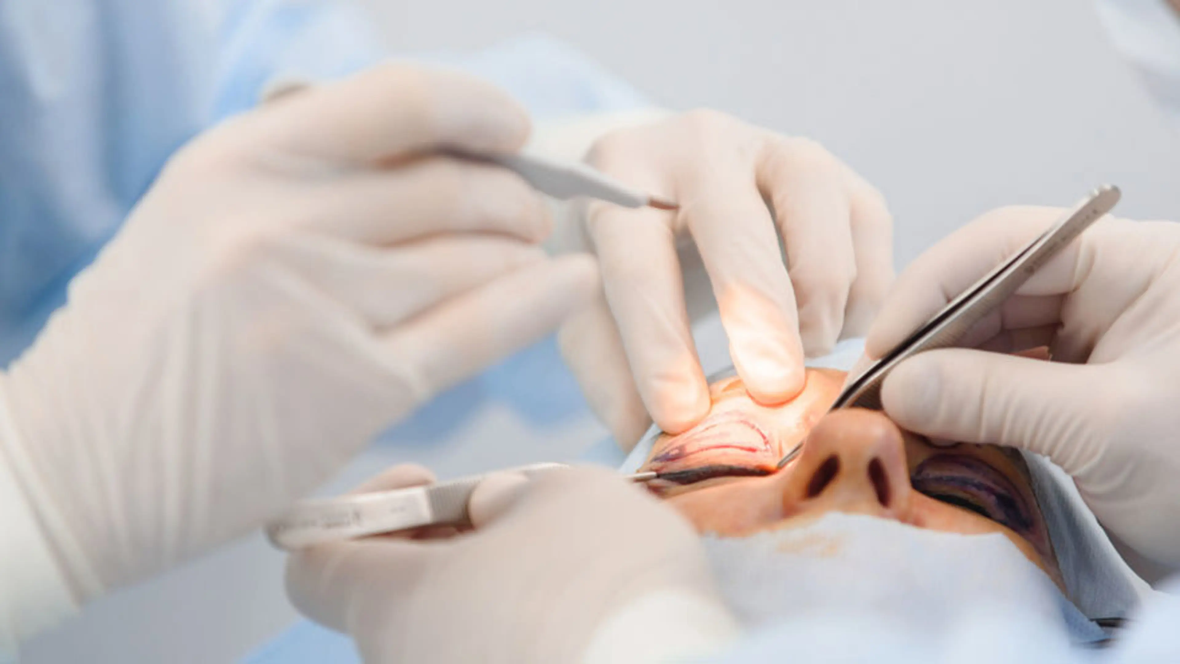 Eyelid Surgery