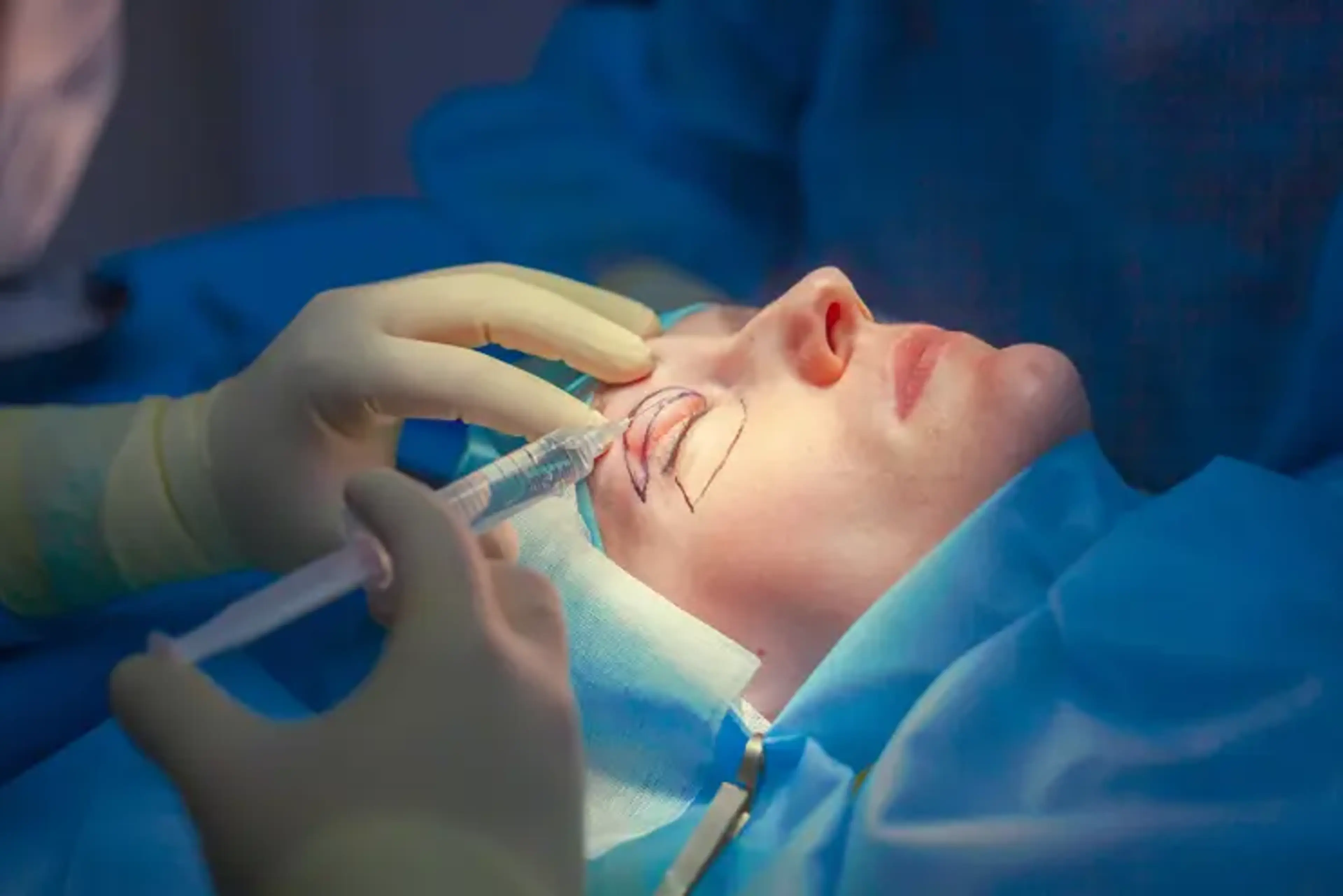 Surgeon performing upper eyelid fat grafting procedure to restore volume and improve eyelid contour during cosmetic eye surgery