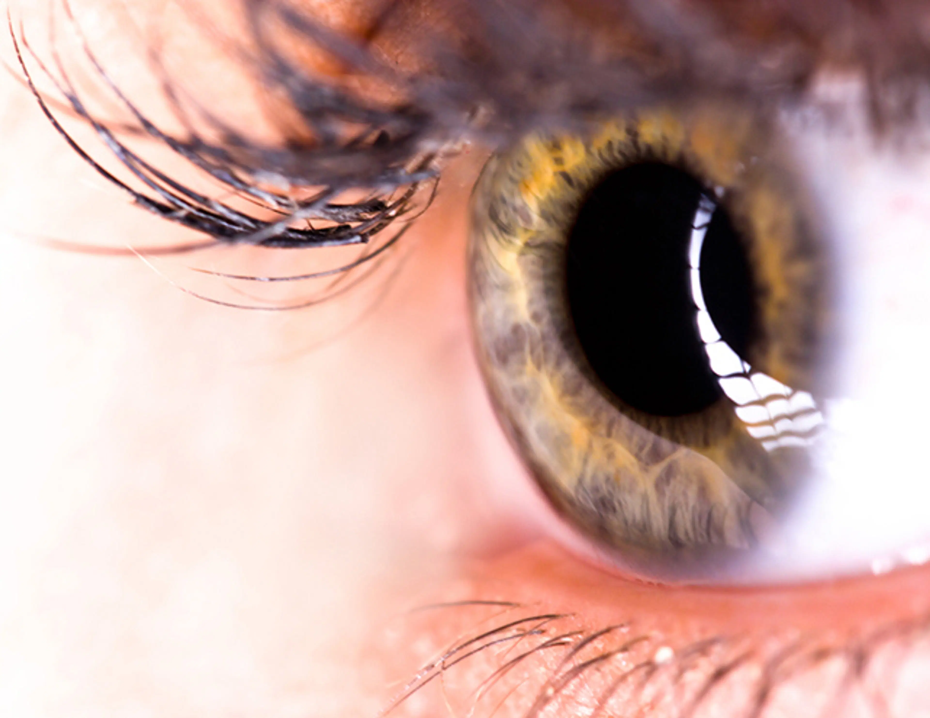 blepharoplasty