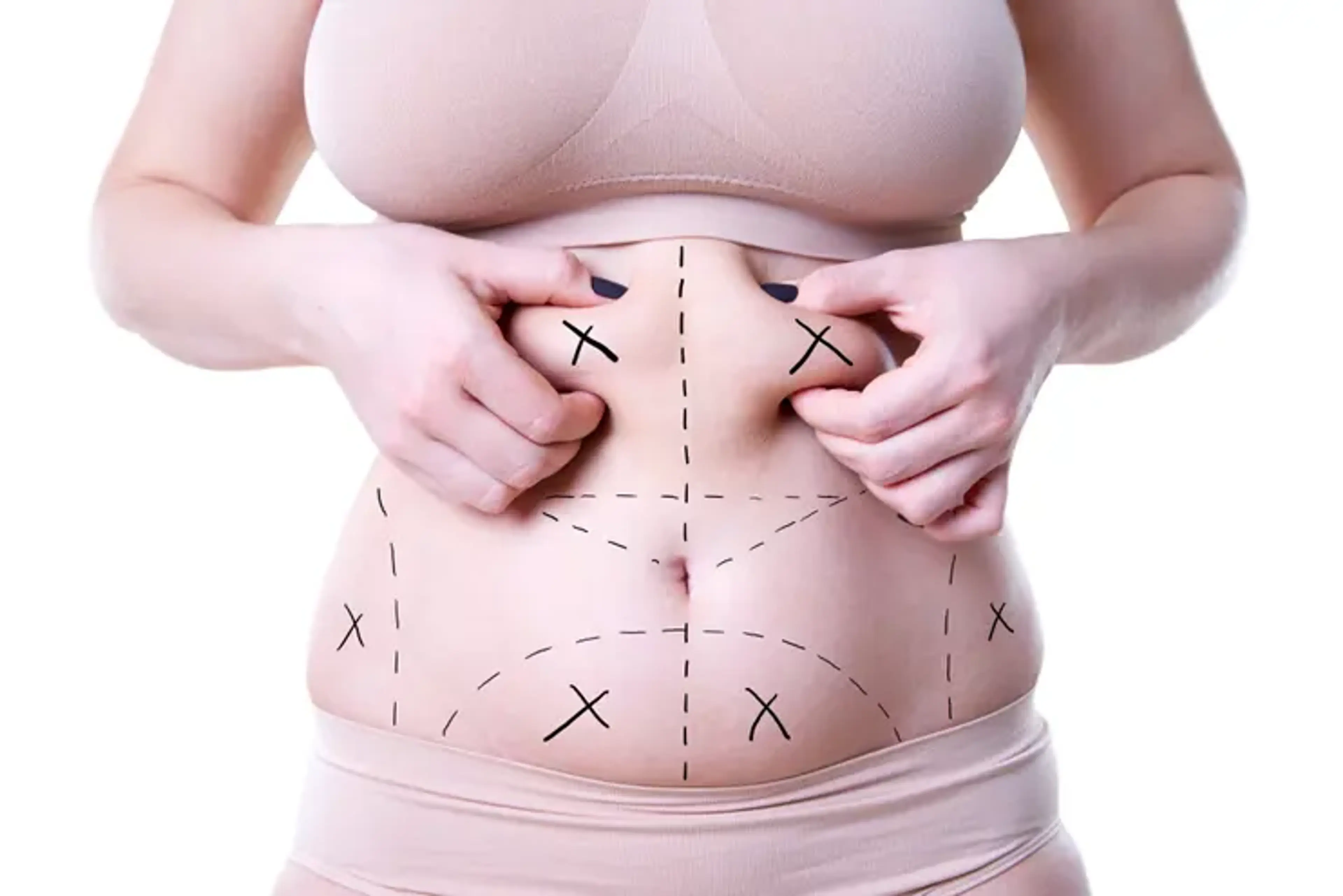Weight Loss