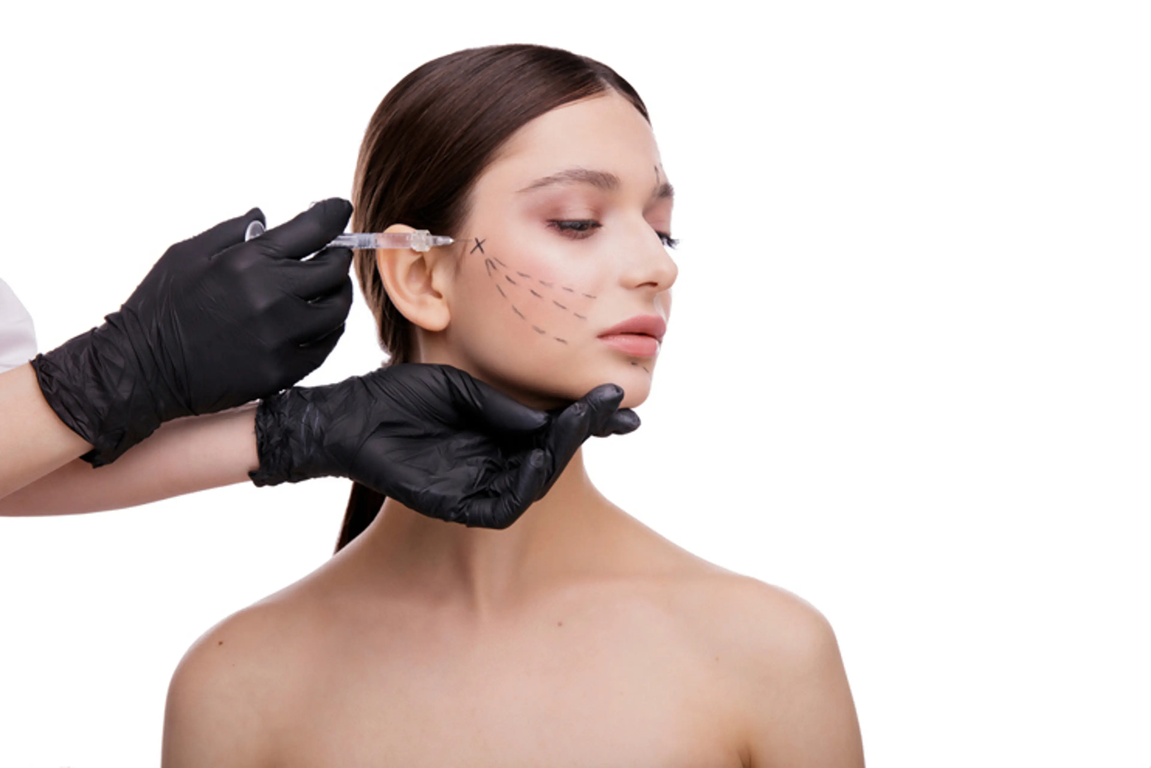 整形手术前后对比