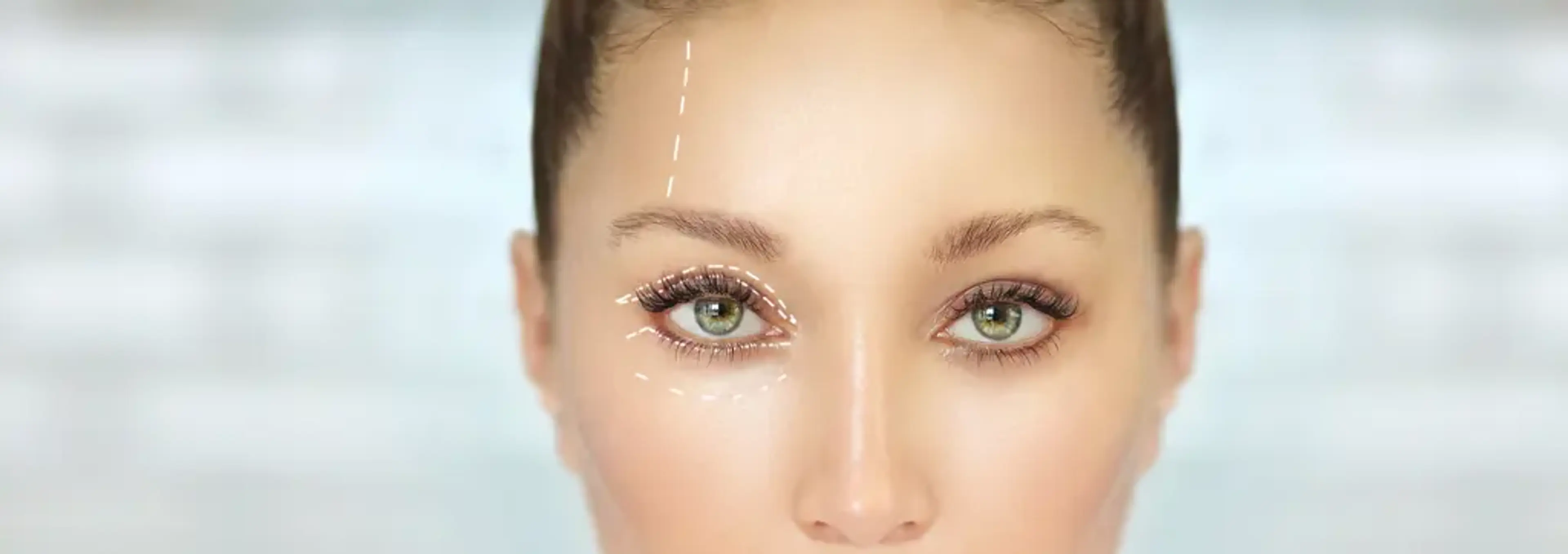 1mm Plastic Surgery