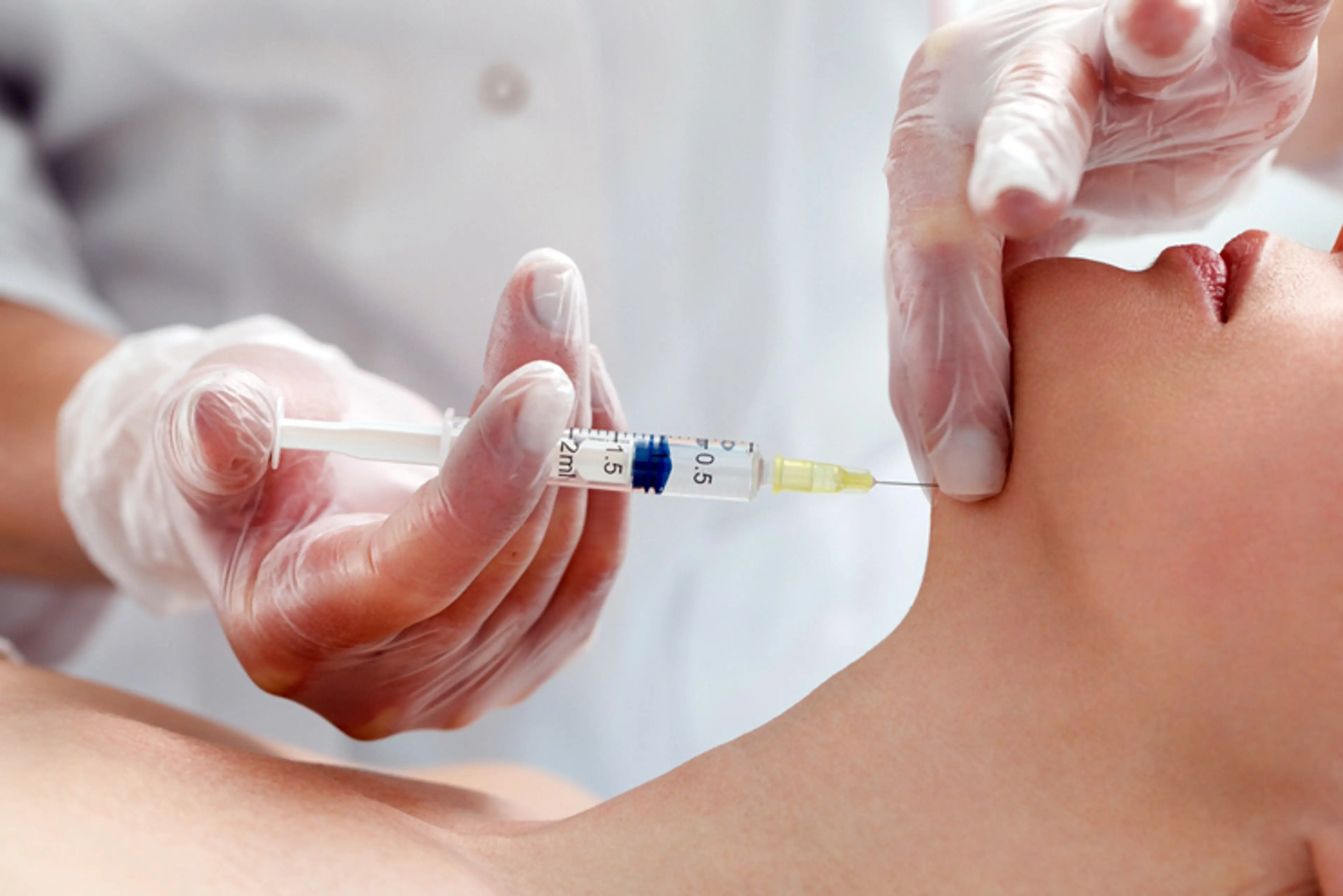 Kybella: Инъекционное решение