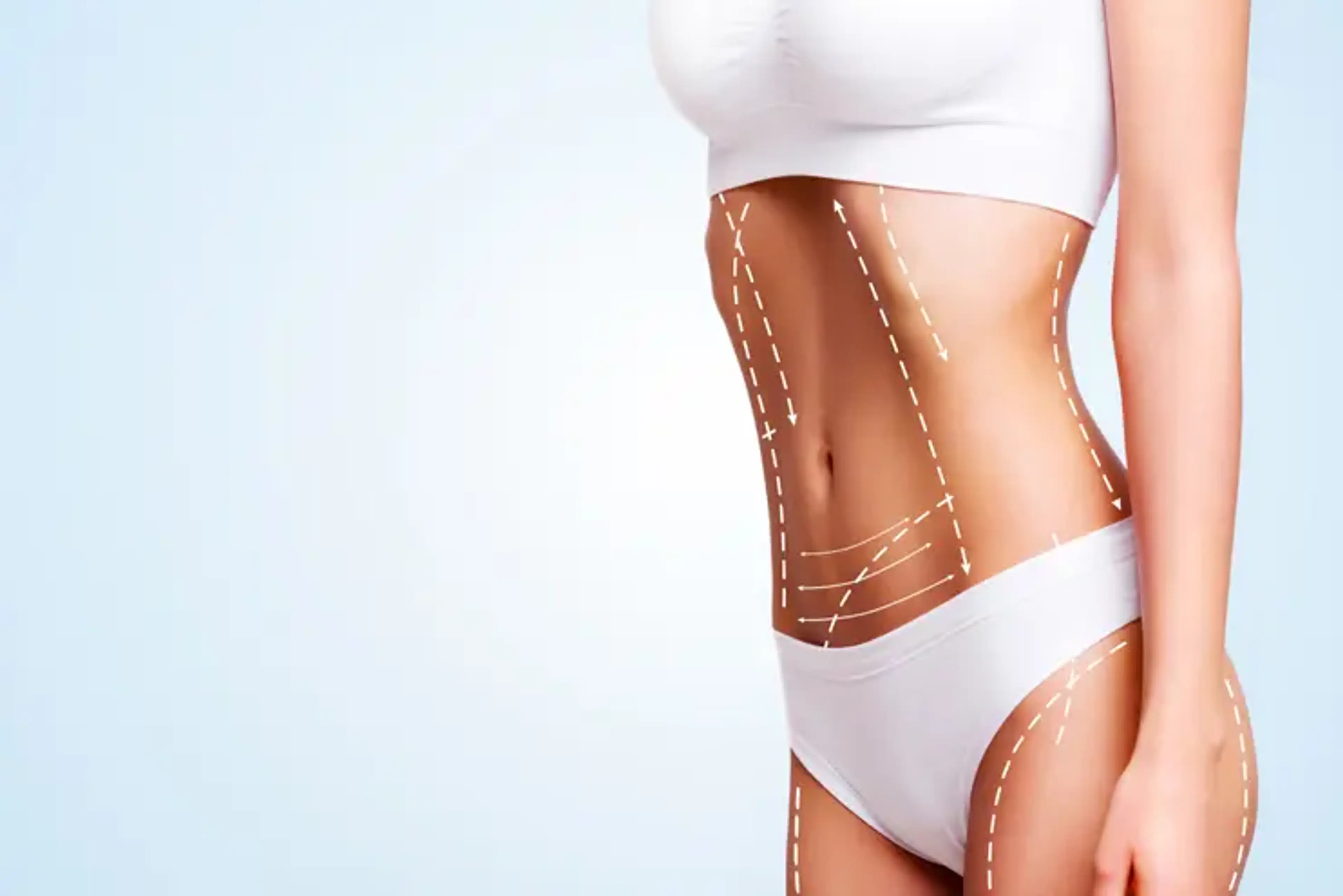 Liposuction South Korea