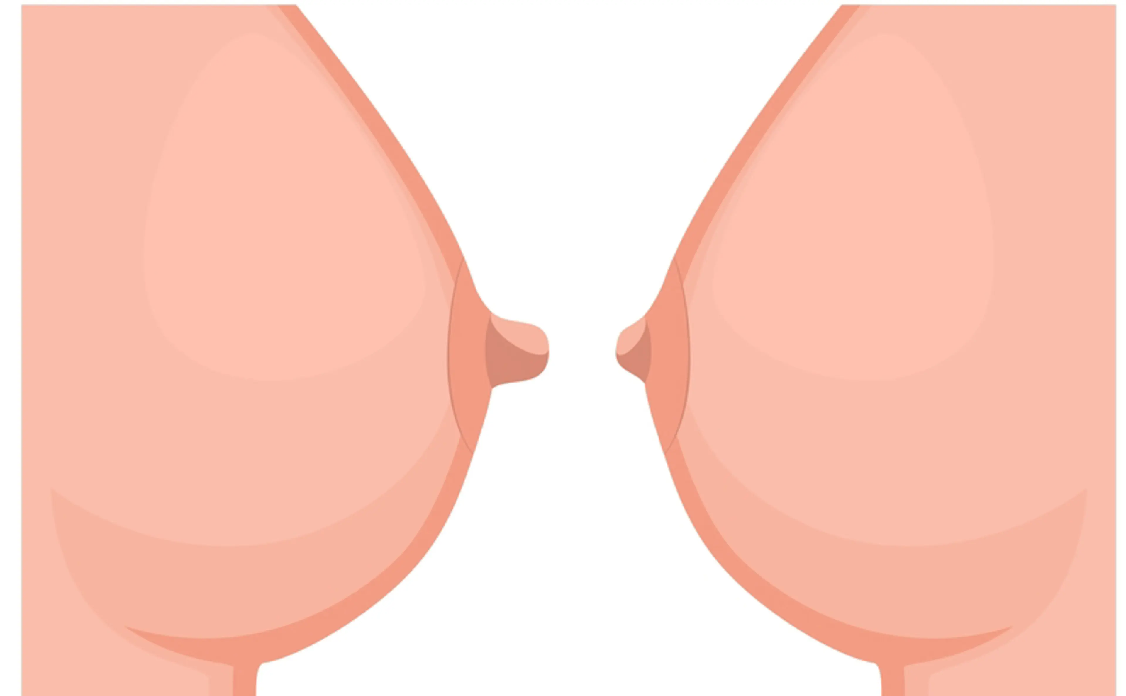 乳頭縮小手術