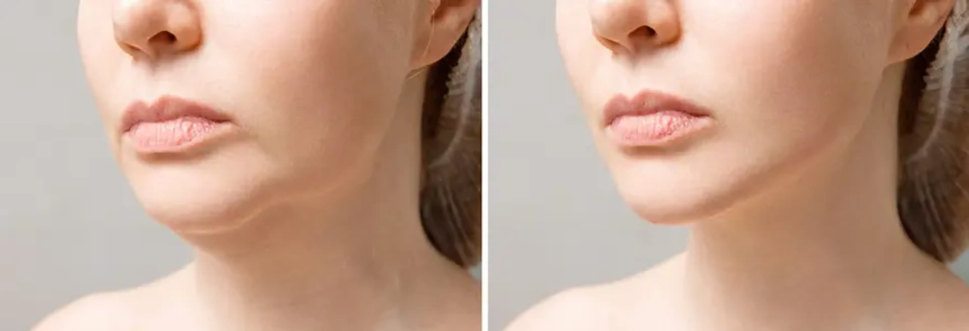 RNWOOD Plastic Surgery