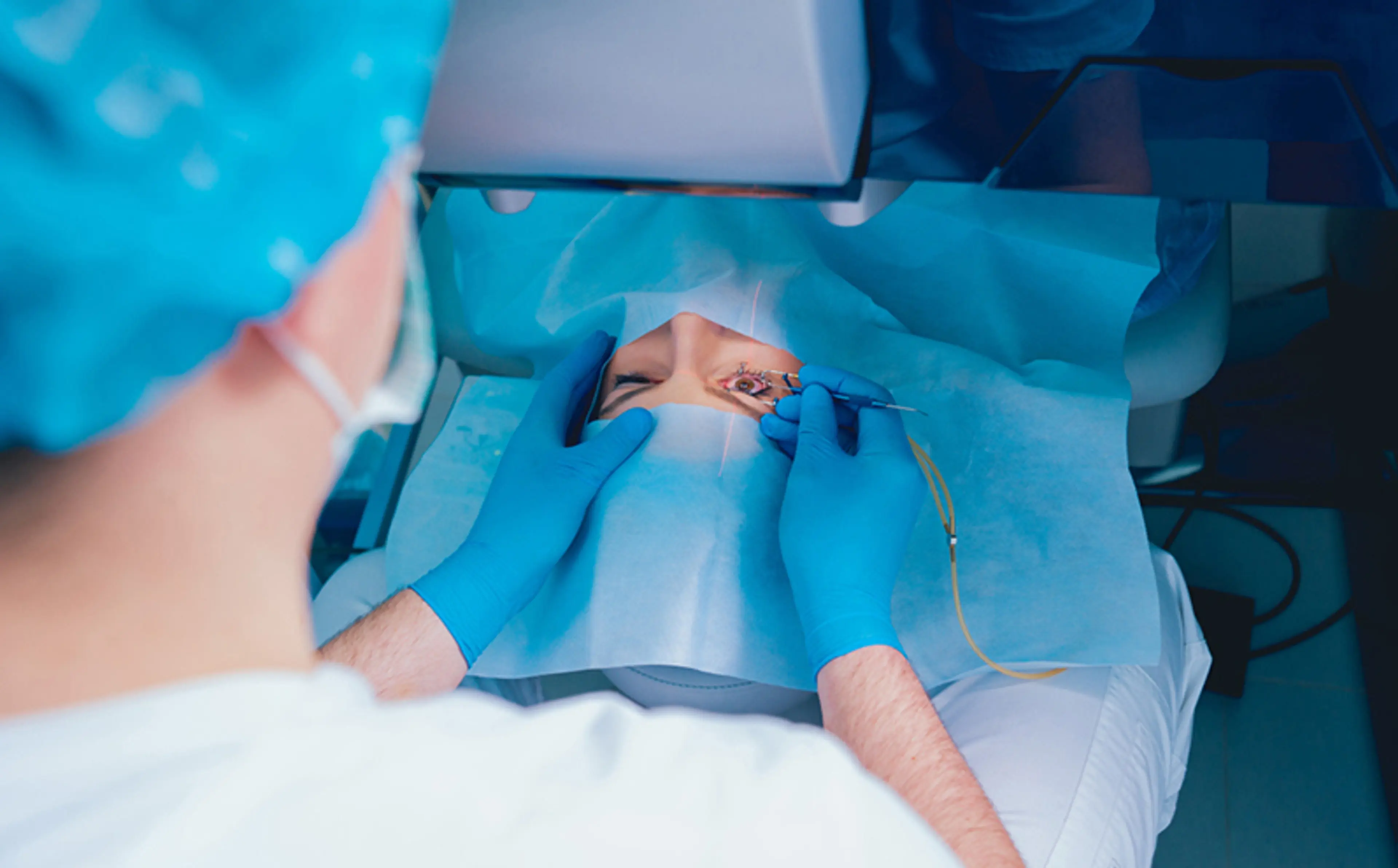 Lens Implant Surgery for Presbyopia
