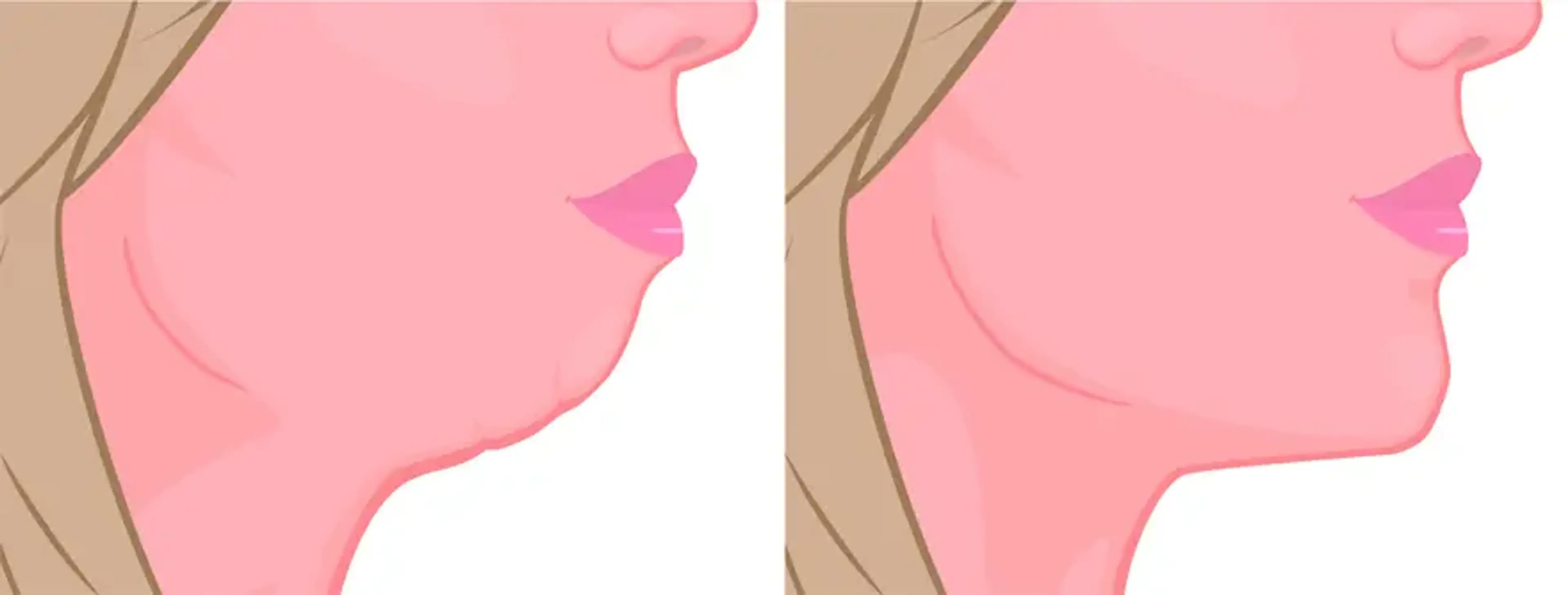 Soon Plus Plastic Surgery
