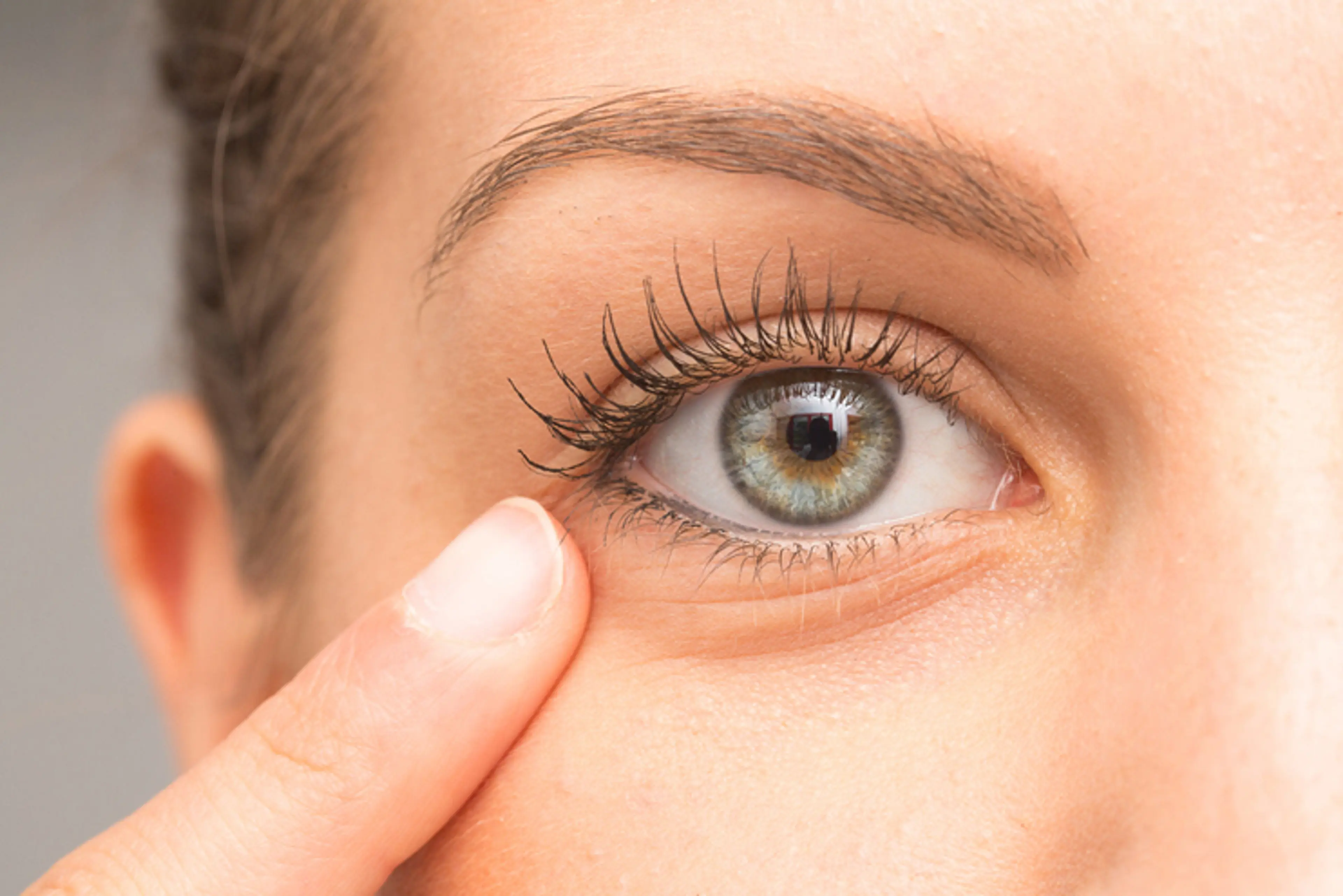 Eye Bag Surgery