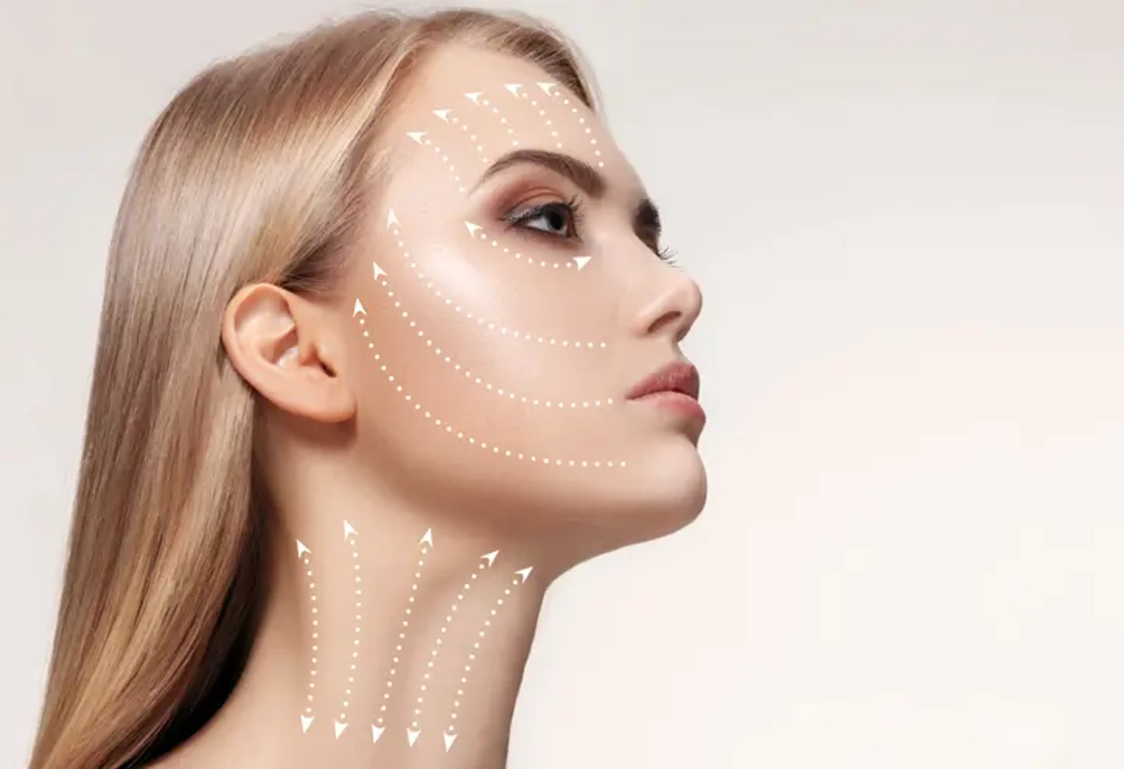 face-lifting